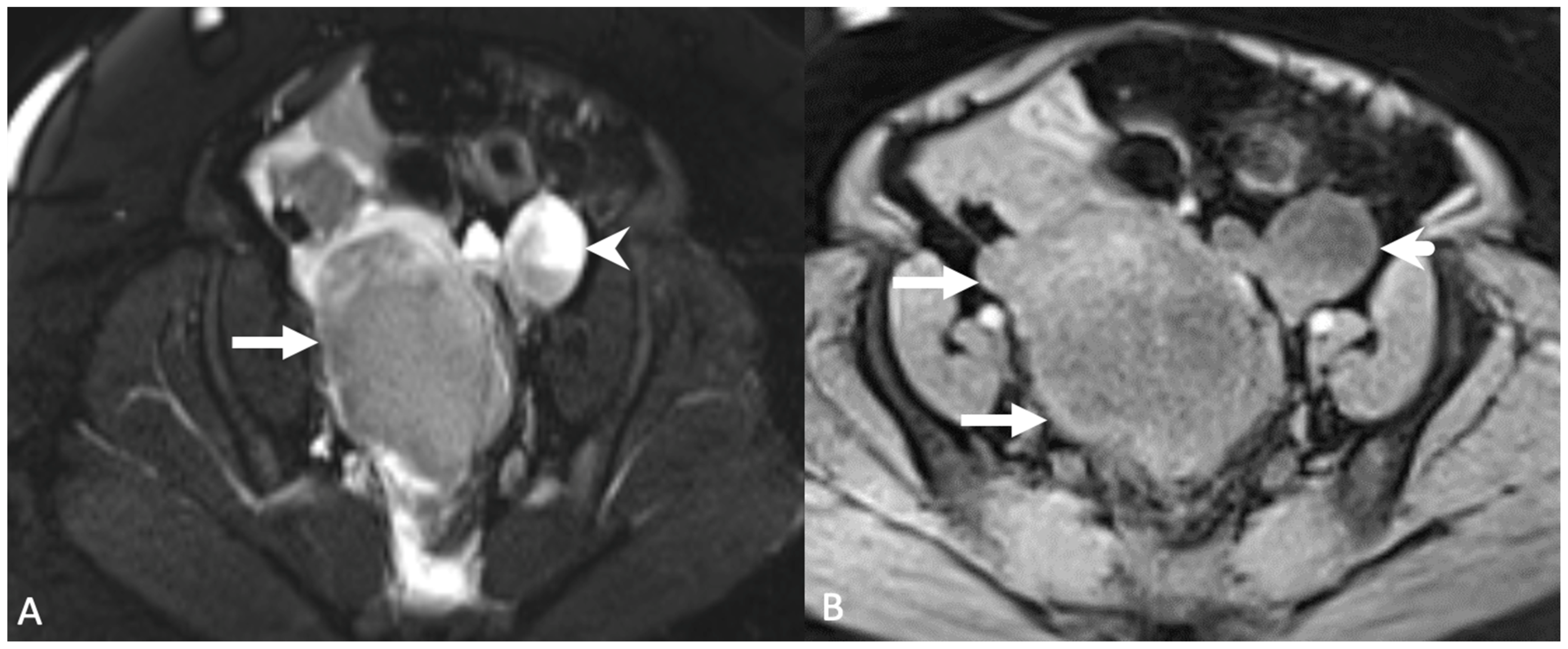 Tomography 08 00009 g015