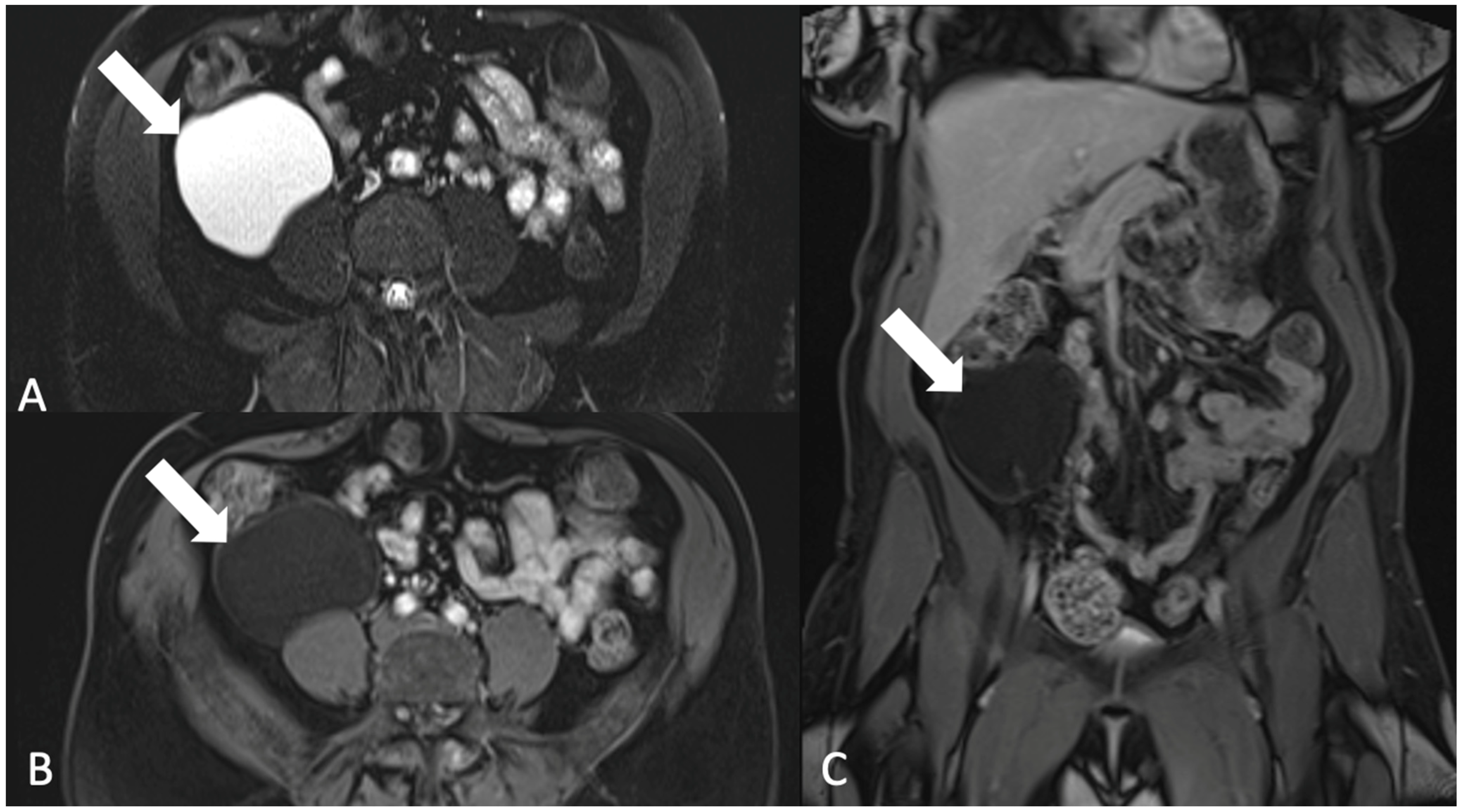 Tomography 08 00009 g016