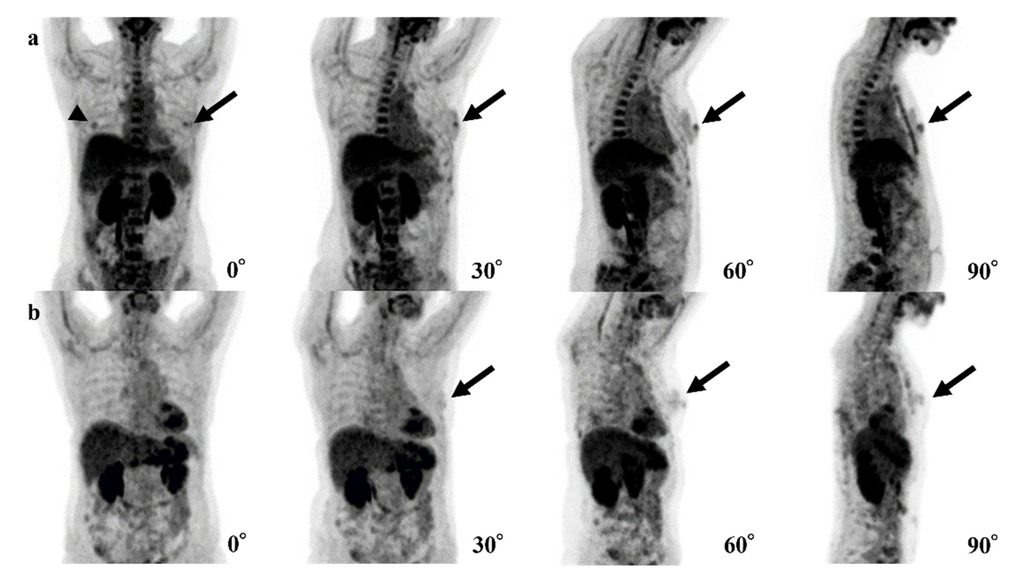 Tomography 08 00011 g003 550