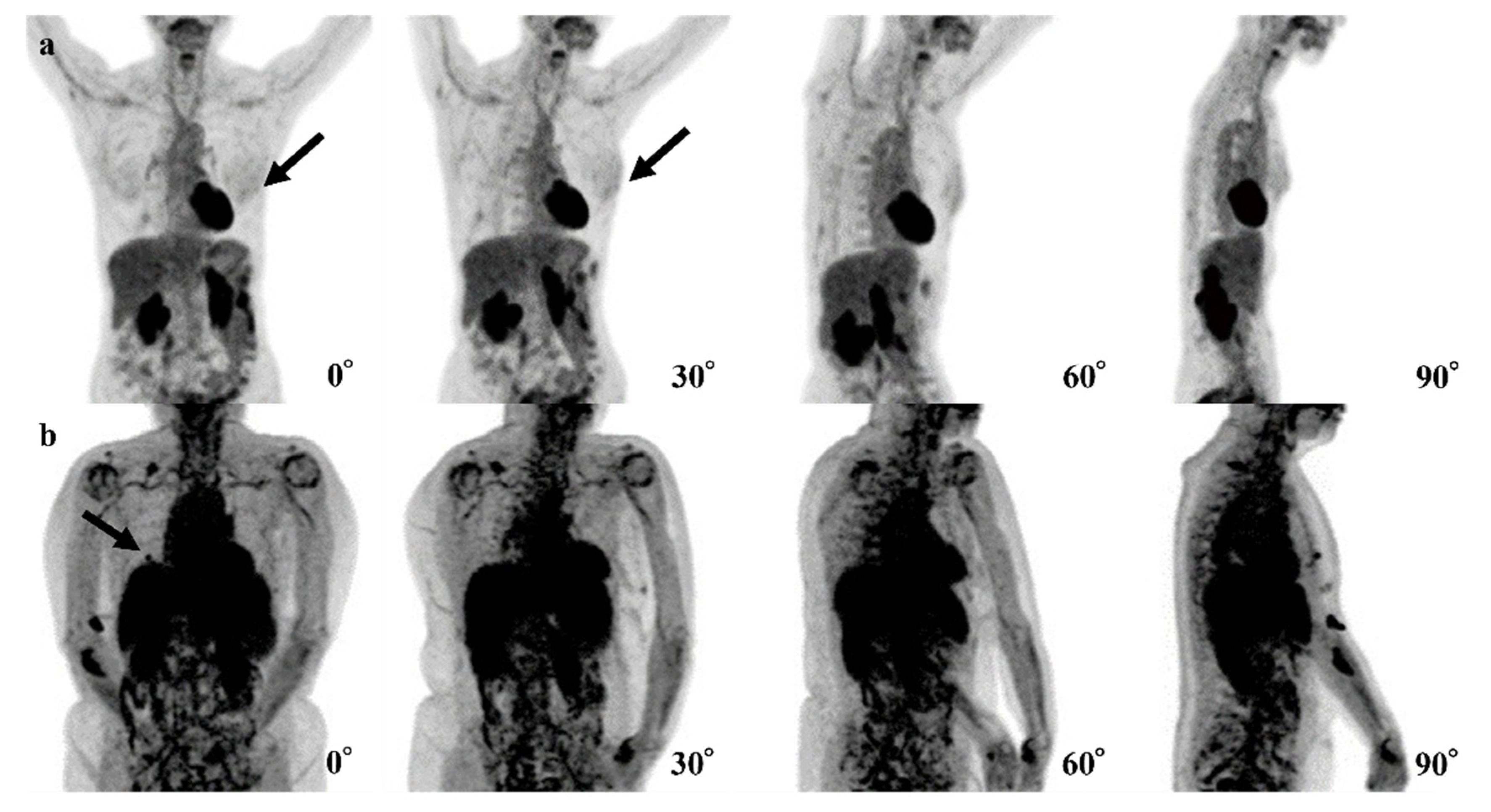 Tomography 08 00011 g004 550