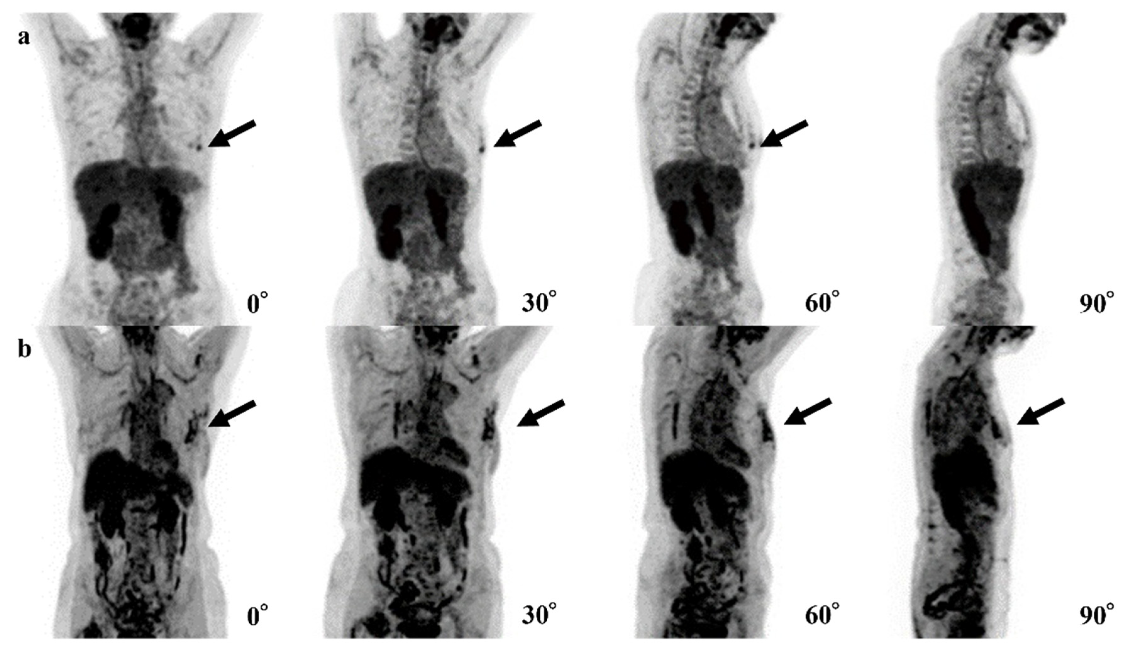 Tomography 08 00011 g005 550