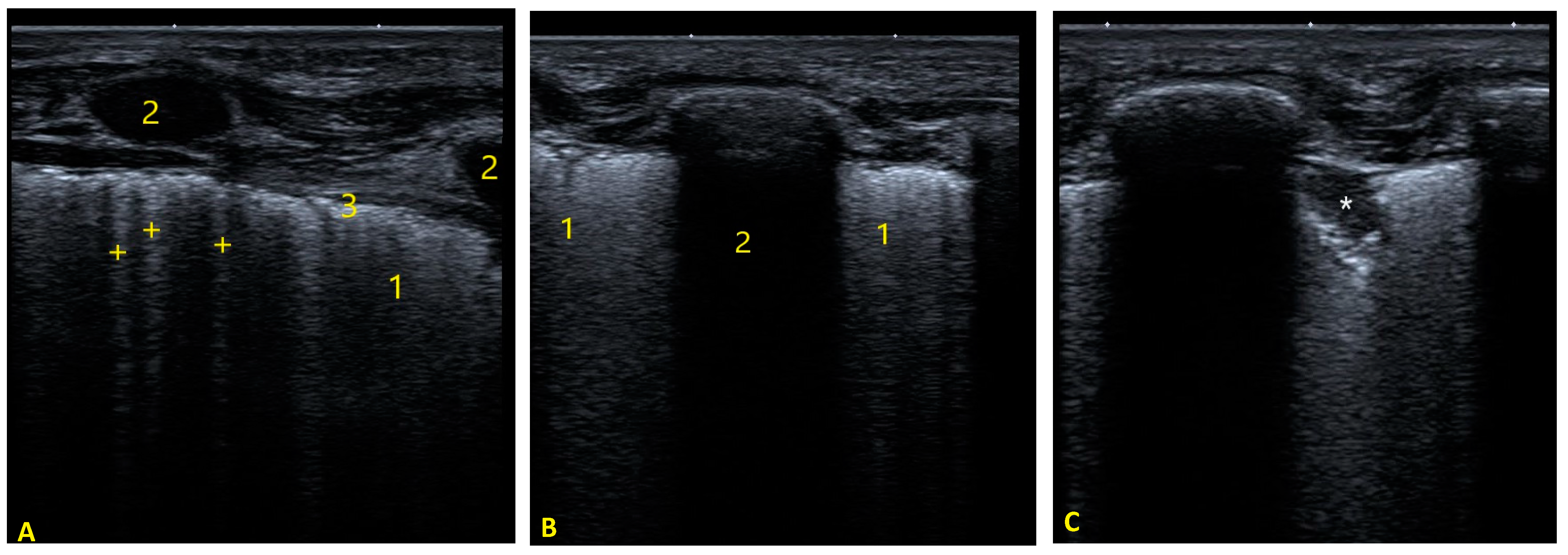 Tomography 08 00012 g003 Tomography 08 00012 g003