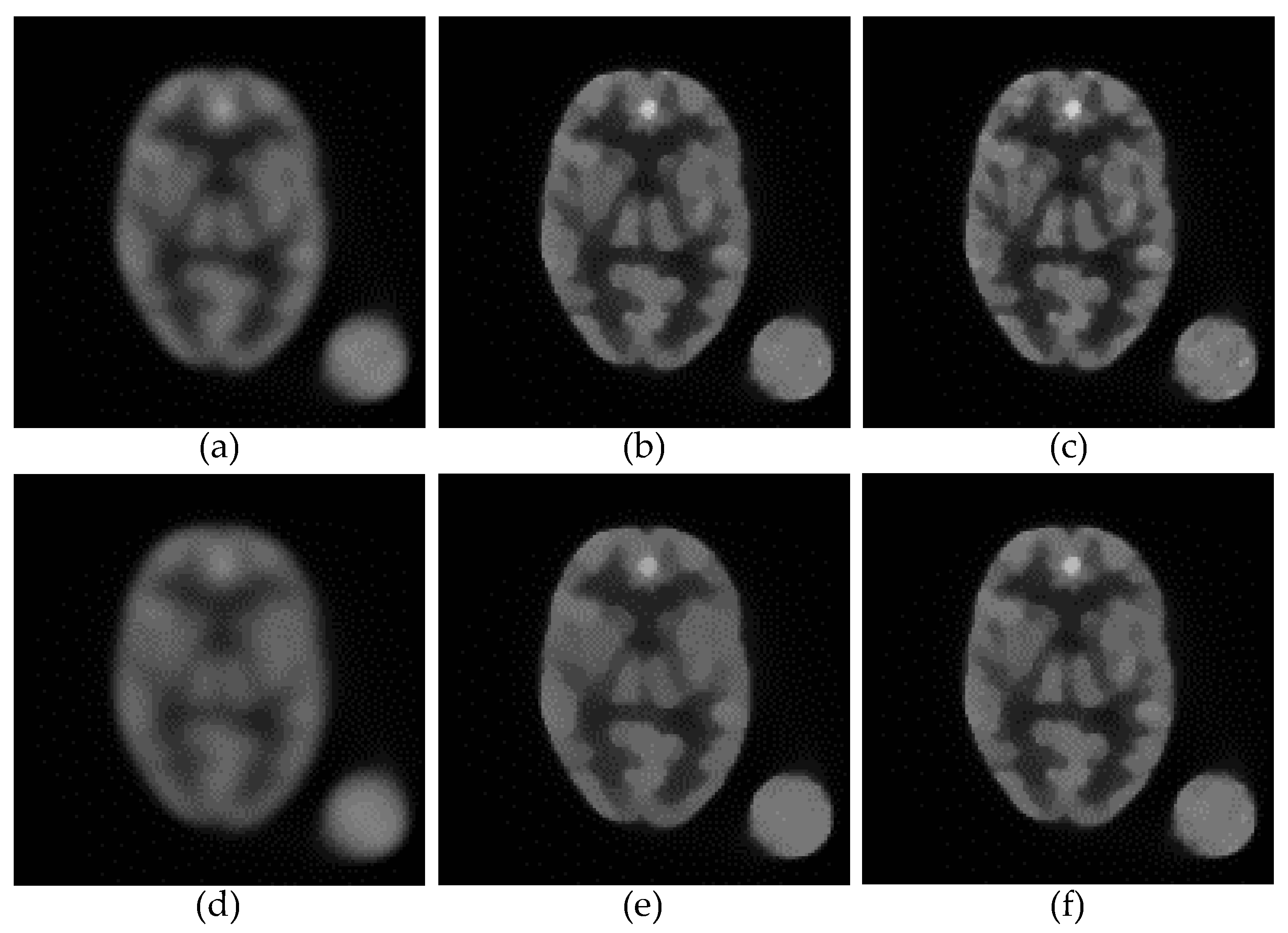Tomography 08 00013 g007