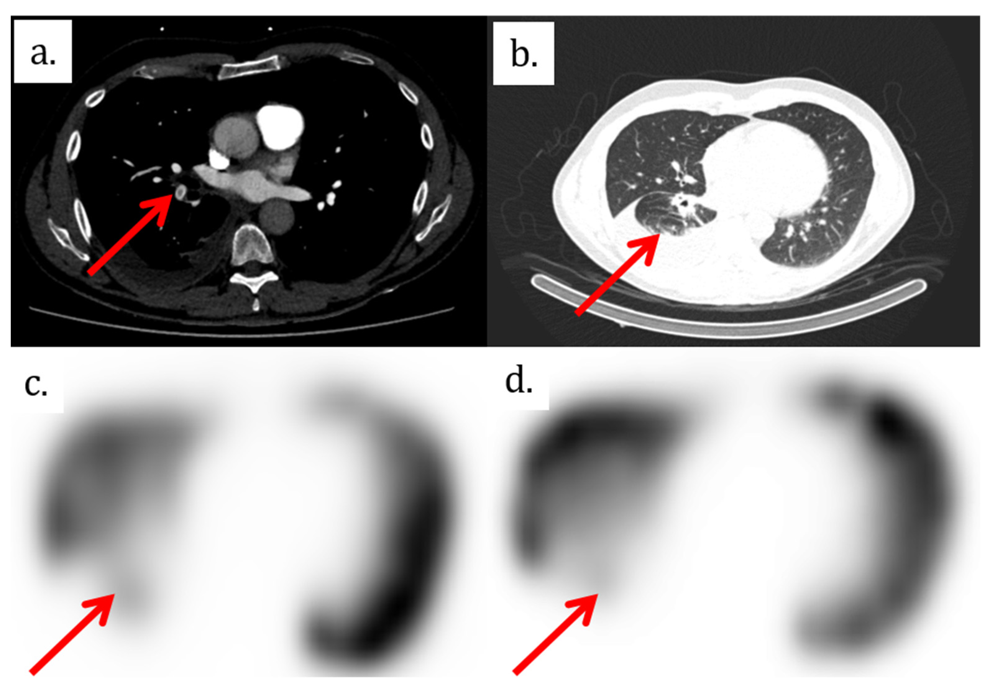 Tomography 08 00014 g001 550