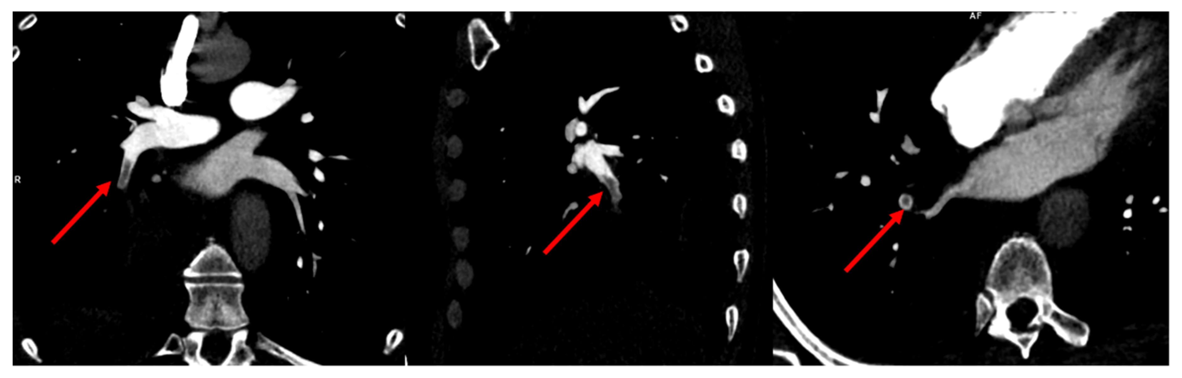 Tomography 08 00014 g002 550