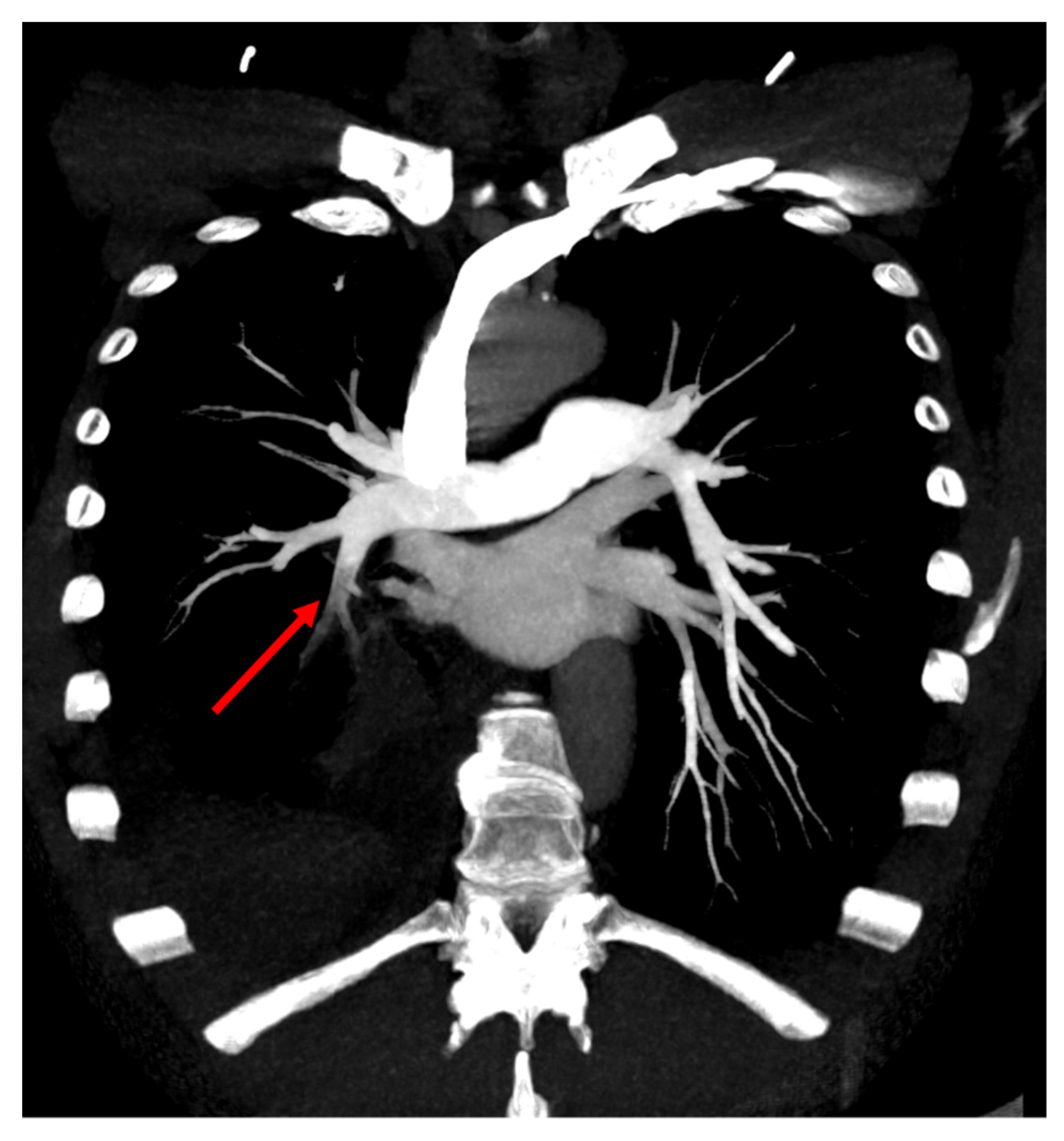 Tomography 08 00014 g003 550
