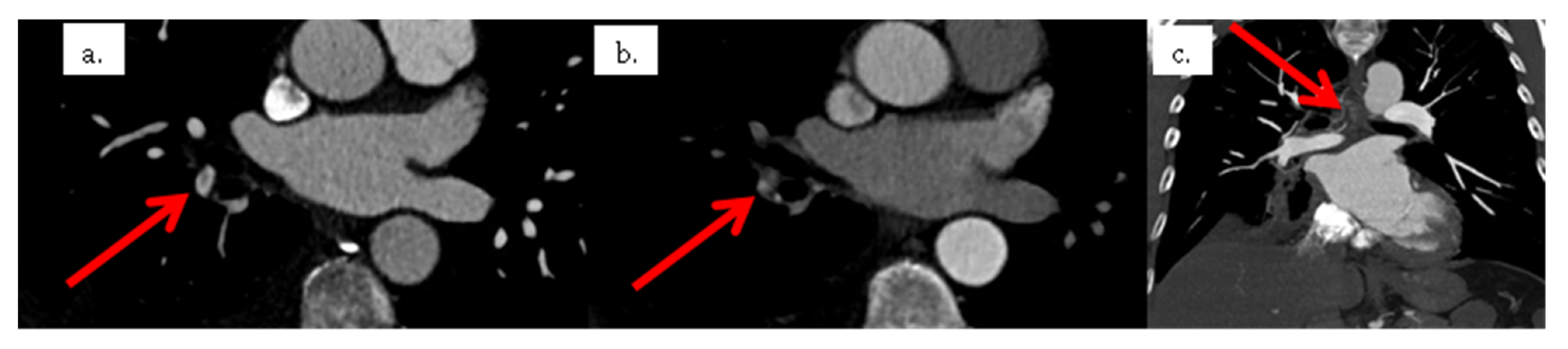 Tomography 08 00014 g004 550