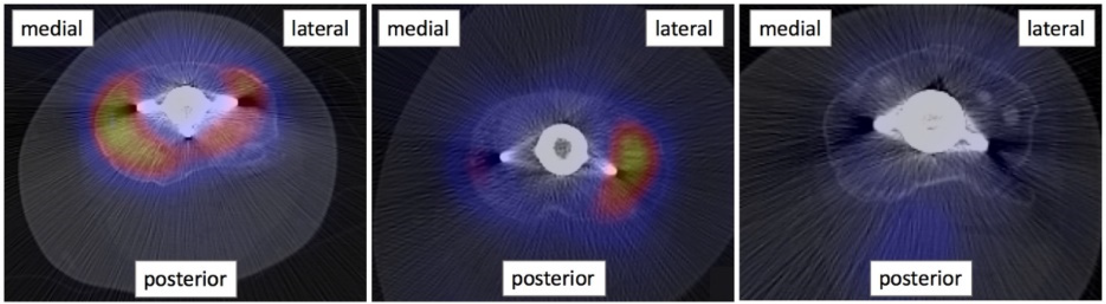 Tomography 08 00015 g003 550
