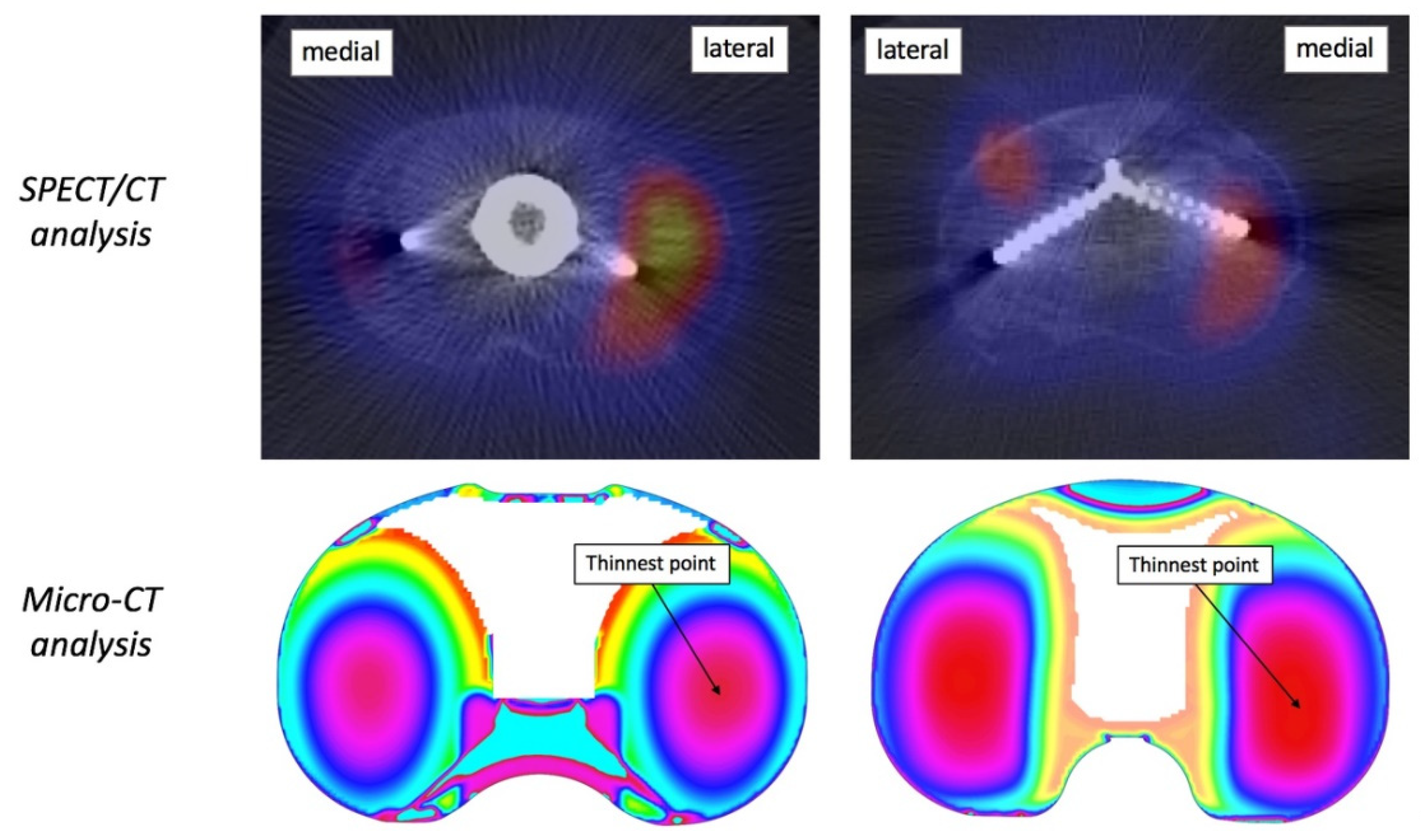 Tomography 08 00015 g006 550