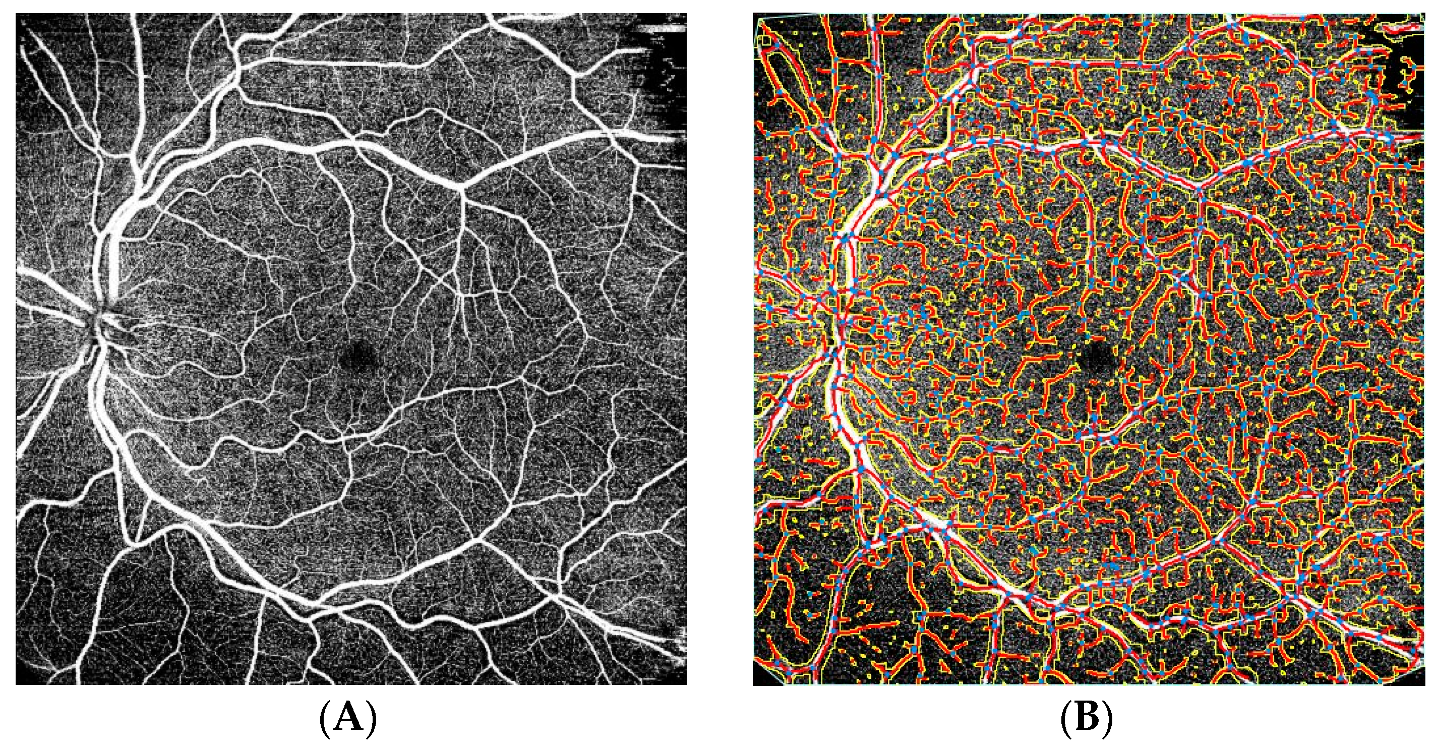 Tomography 08 00016 g002