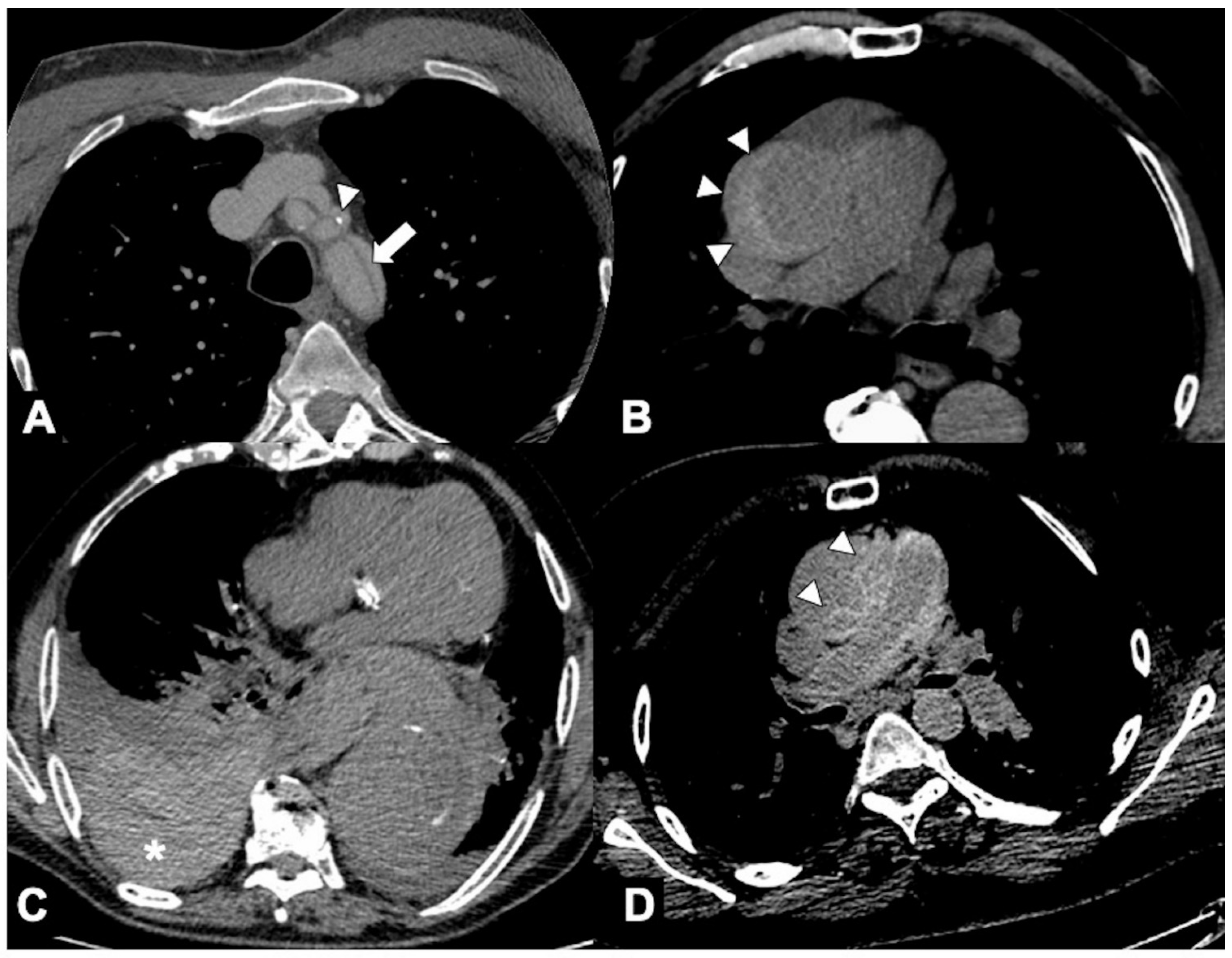 Tomography 08 00017 g002 Tomography 08 00017 g002