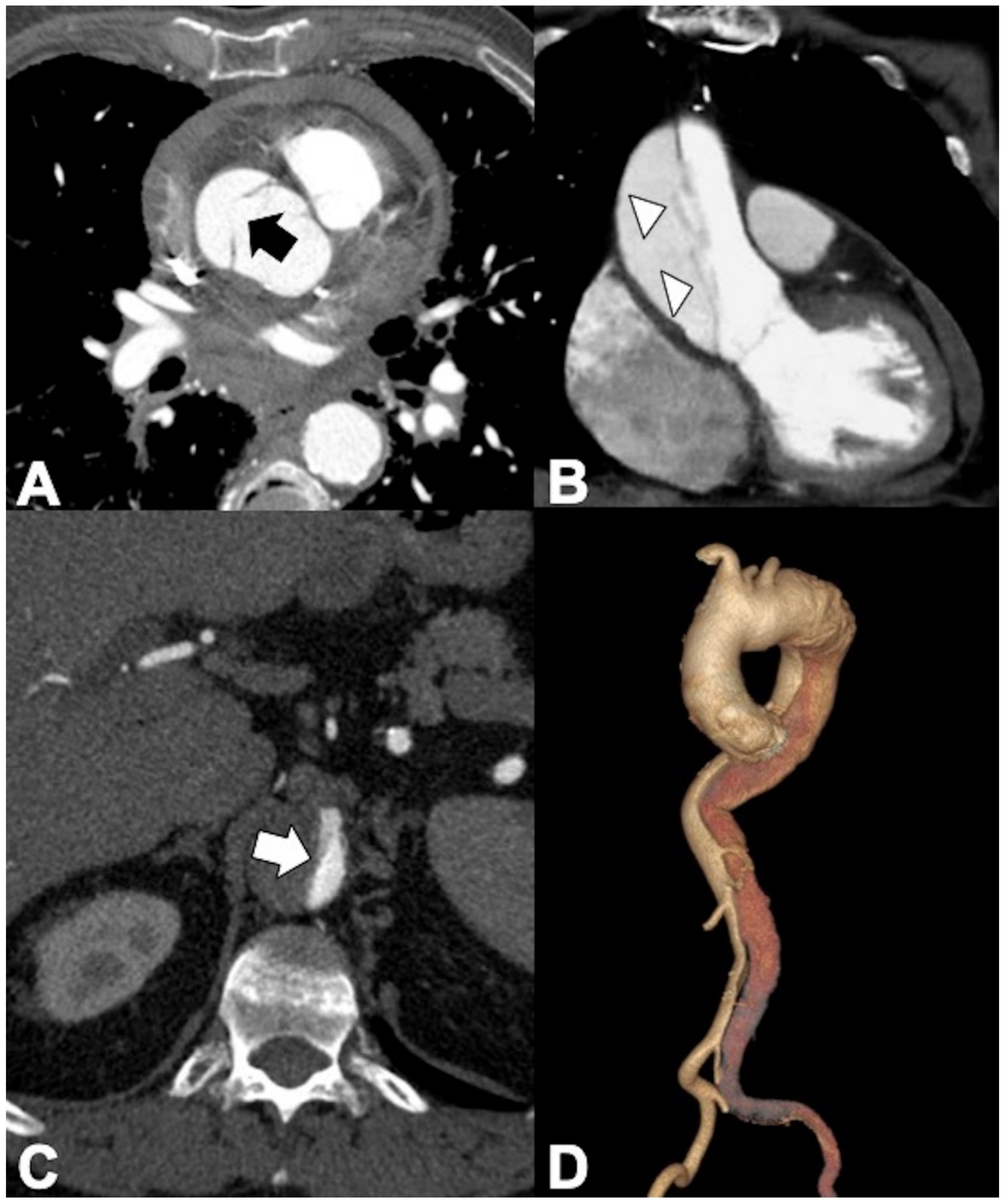 Tomography 08 00017 g005 Tomography 08 00017 g005