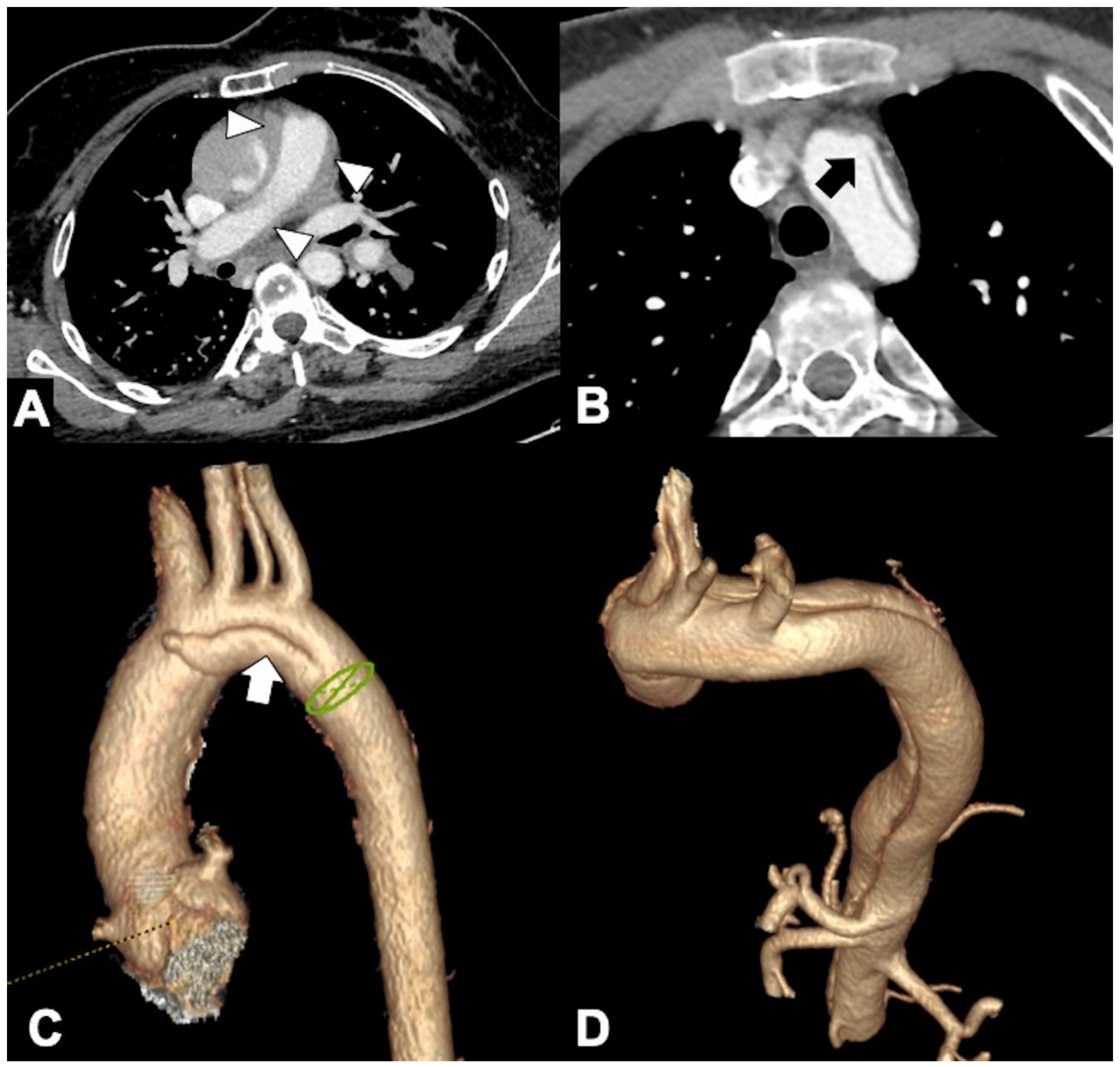 Tomography 08 00017 g007 Tomography 08 00017 g007