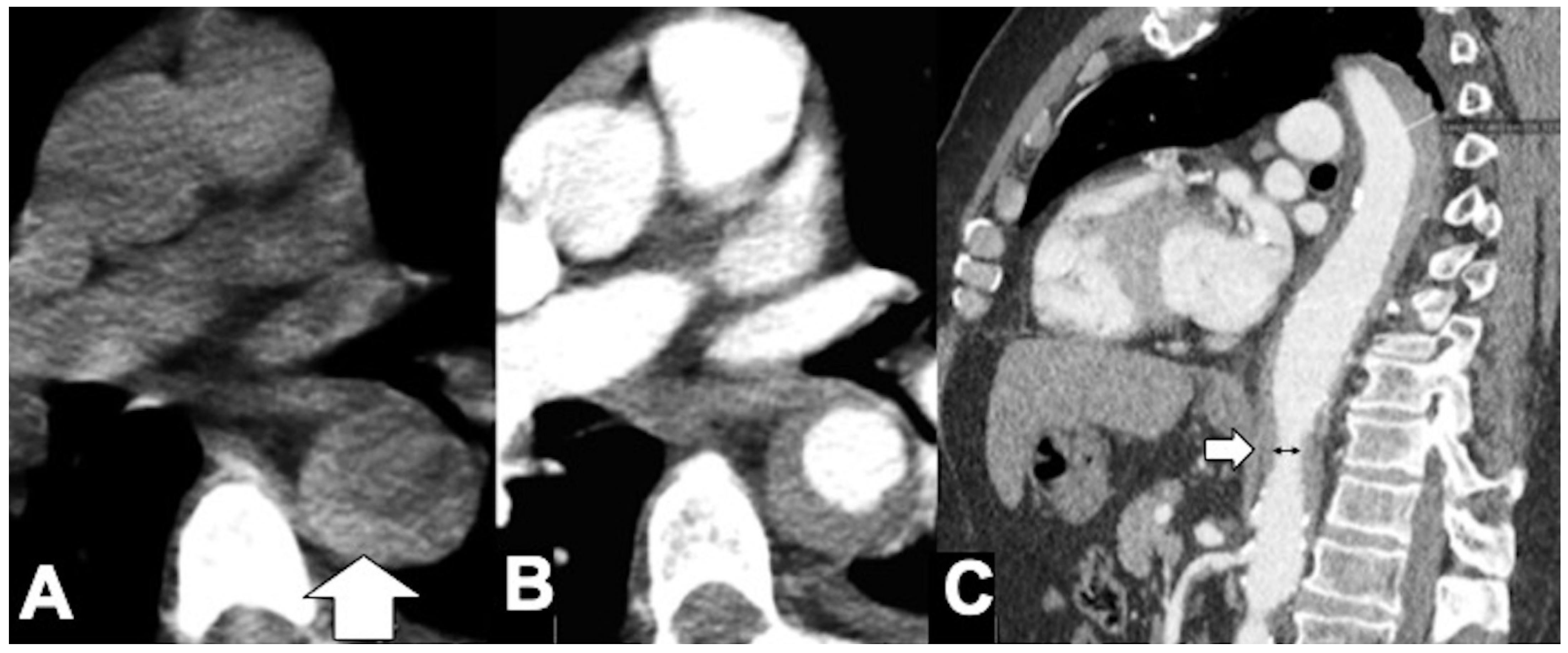 Tomography 08 00017 g008 Tomography 08 00017 g008