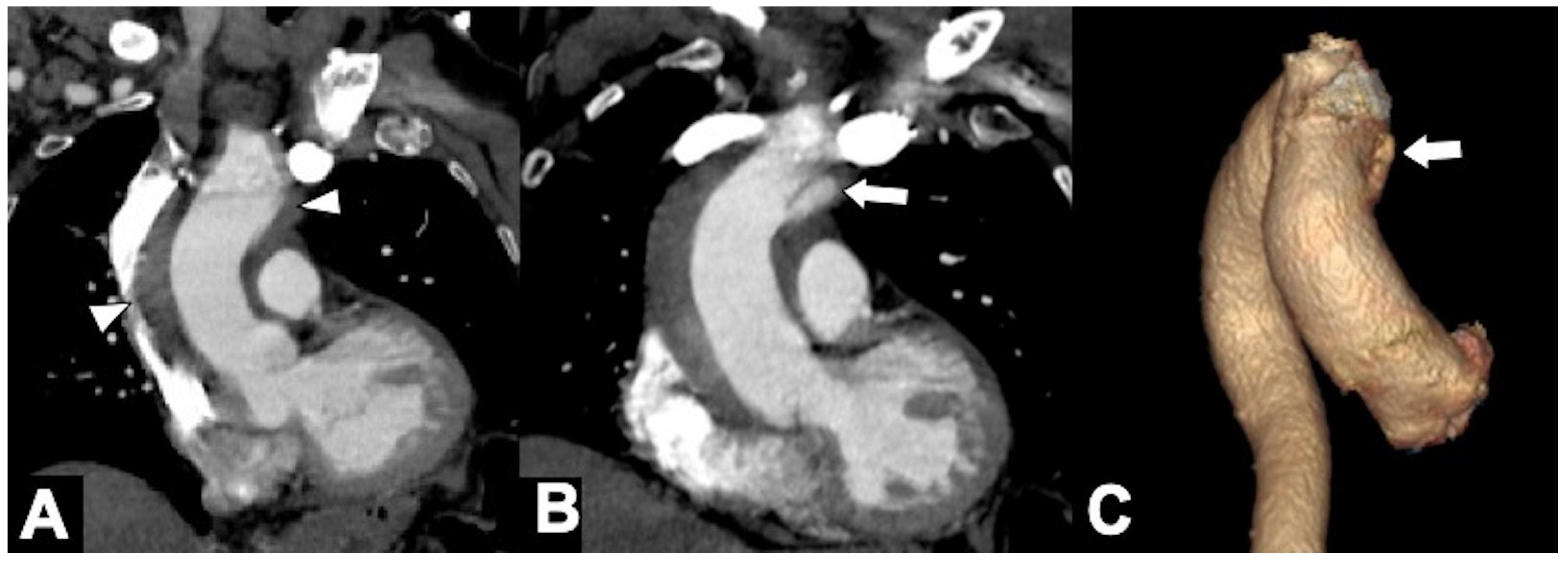 Tomography 08 00017 g009 Tomography 08 00017 g009