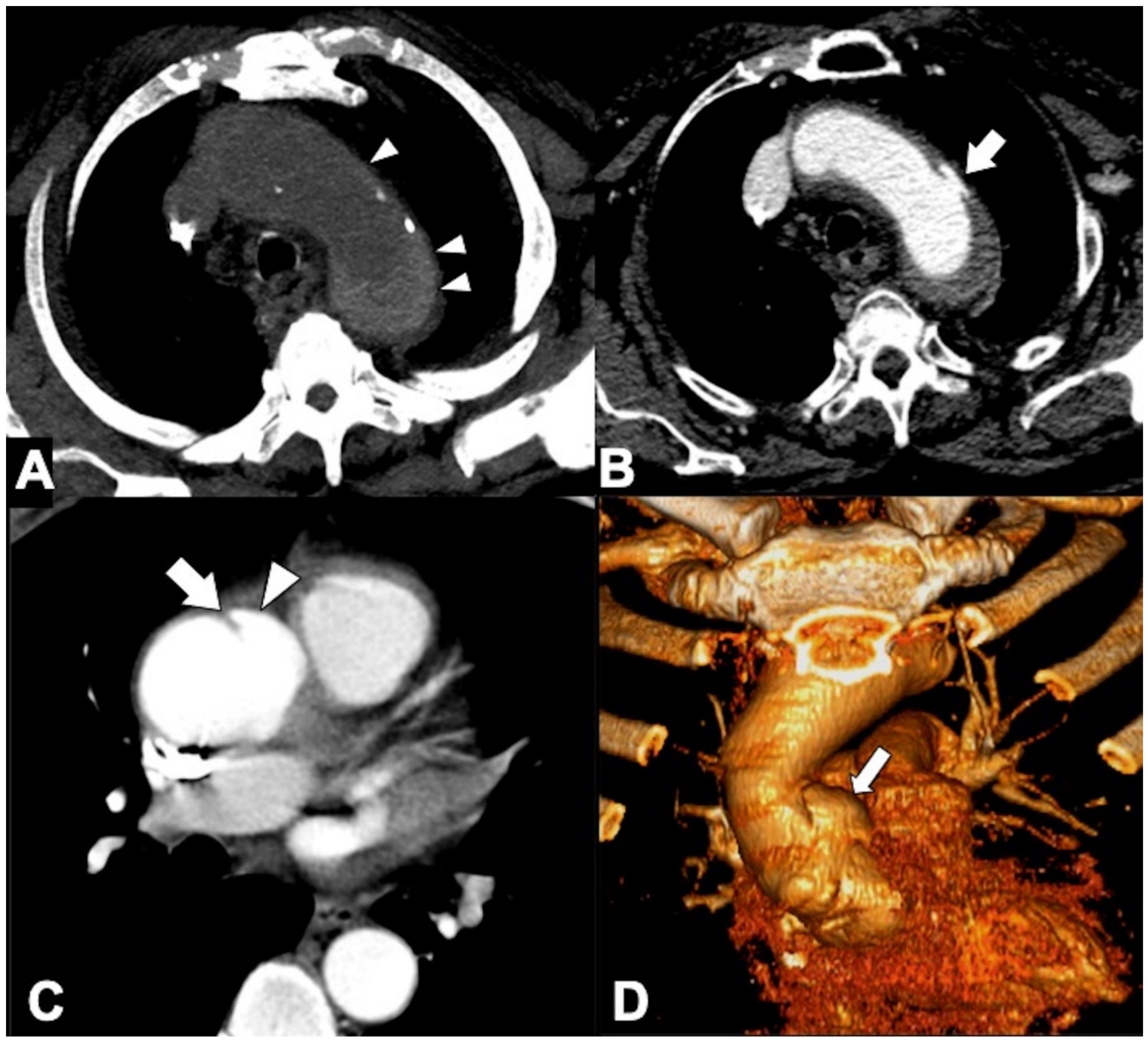 Tomography 08 00017 g010 Tomography 08 00017 g010