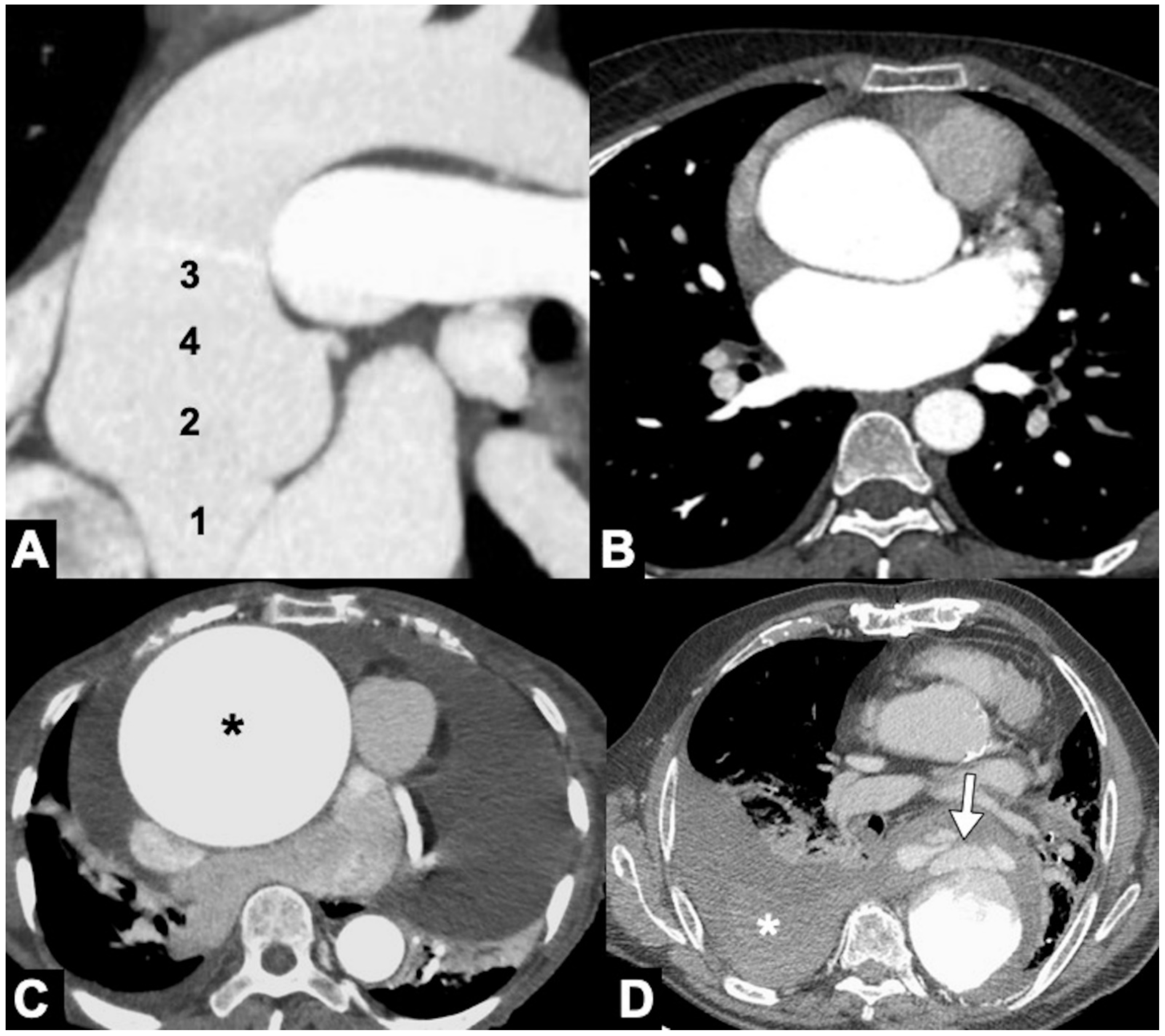 Tomography 08 00017 g011 Tomography 08 00017 g011
