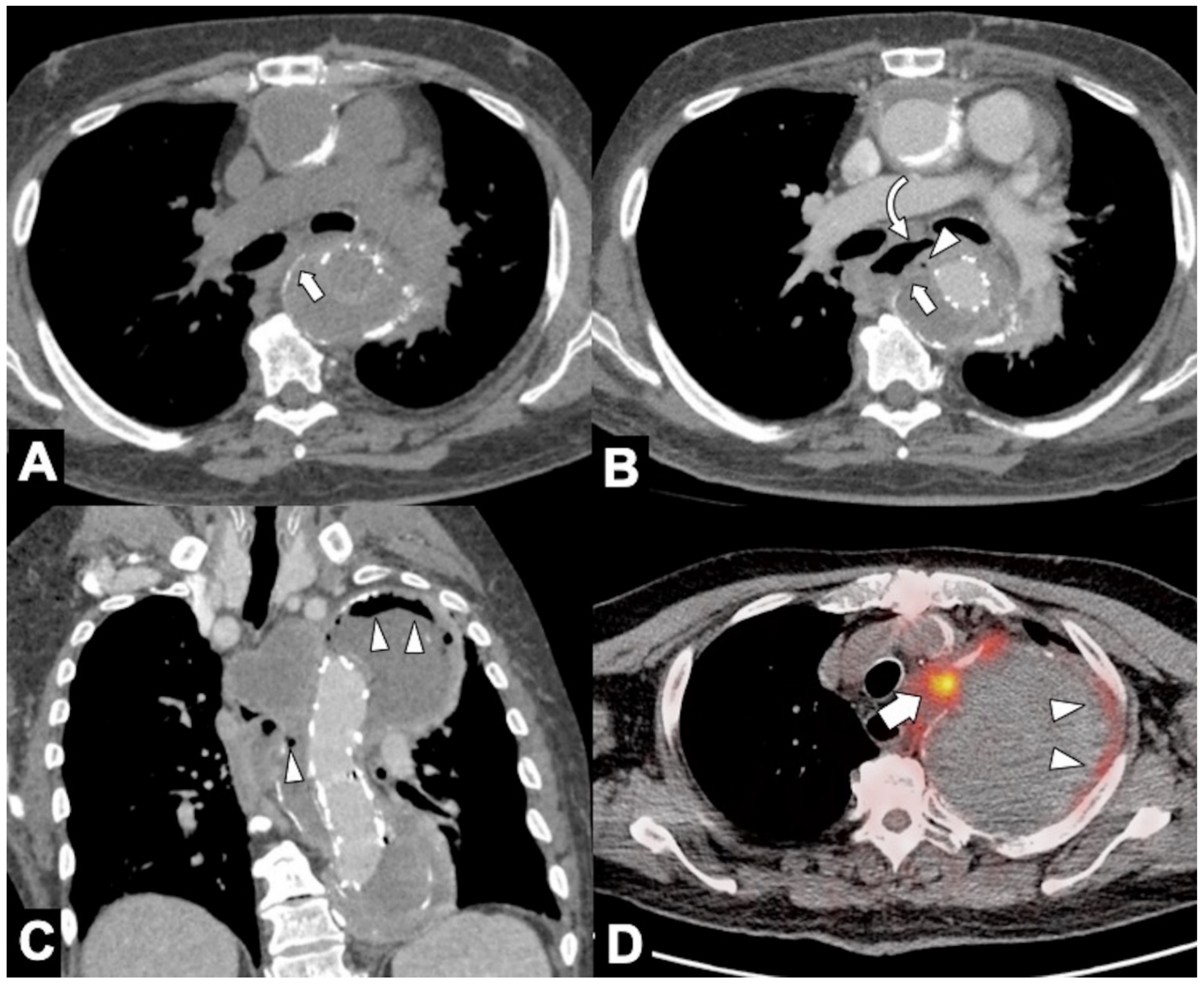 Tomography 08 00017 g013 Tomography 08 00017 g013
