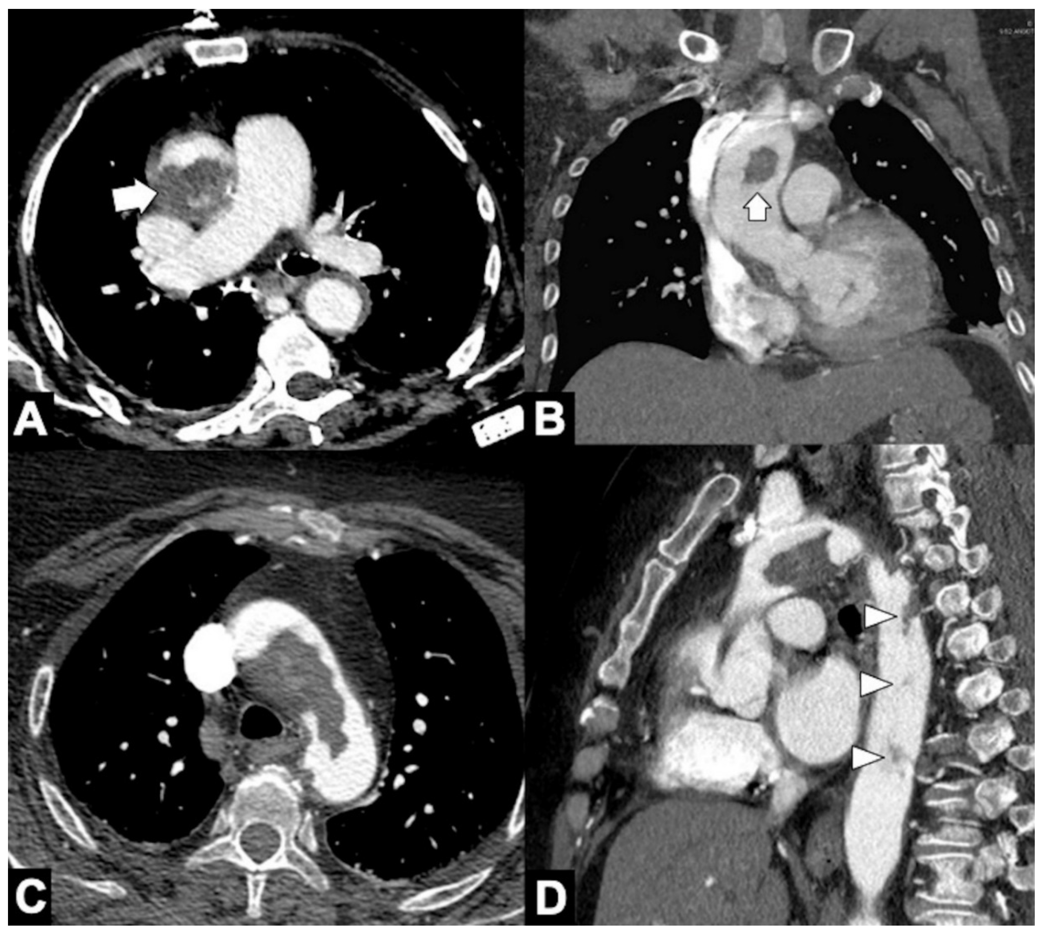 Tomography 08 00017 g015 Tomography 08 00017 g015