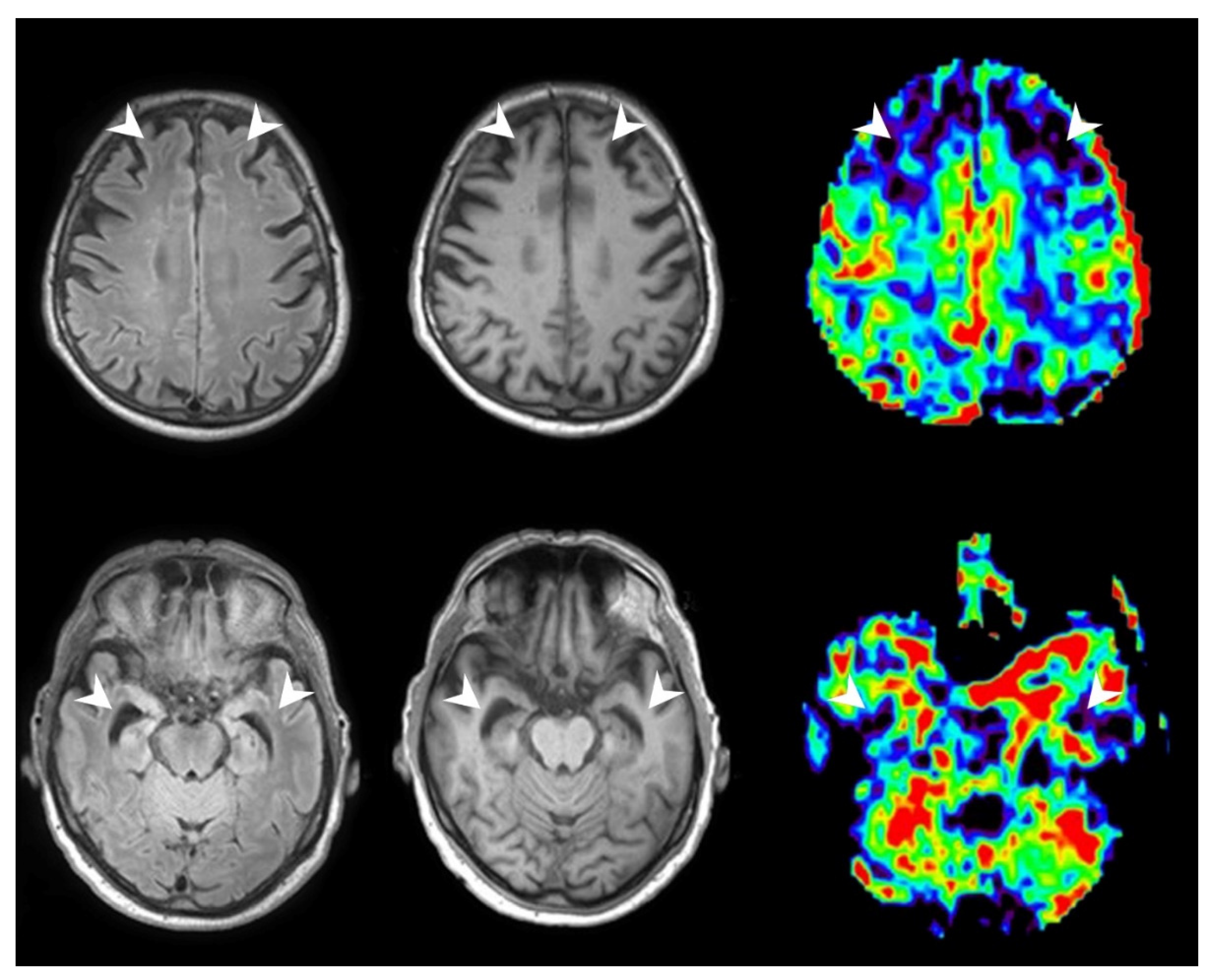 Tomography 08 00018 g004 550