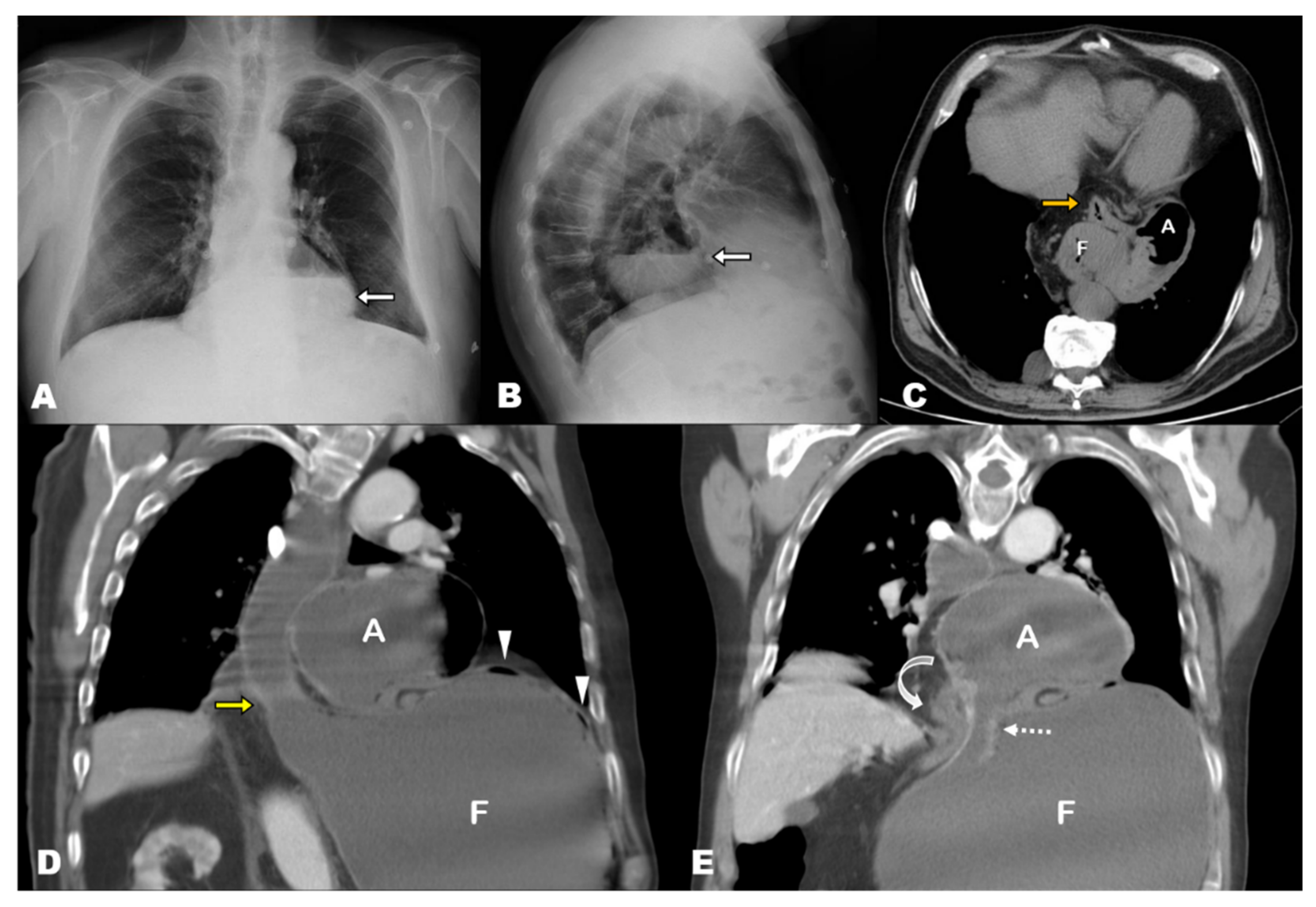 Tomography 08 00019 g001 550