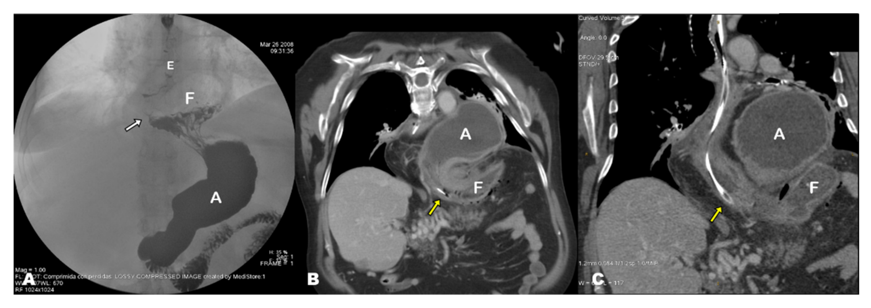 Tomography 08 00019 g003 550