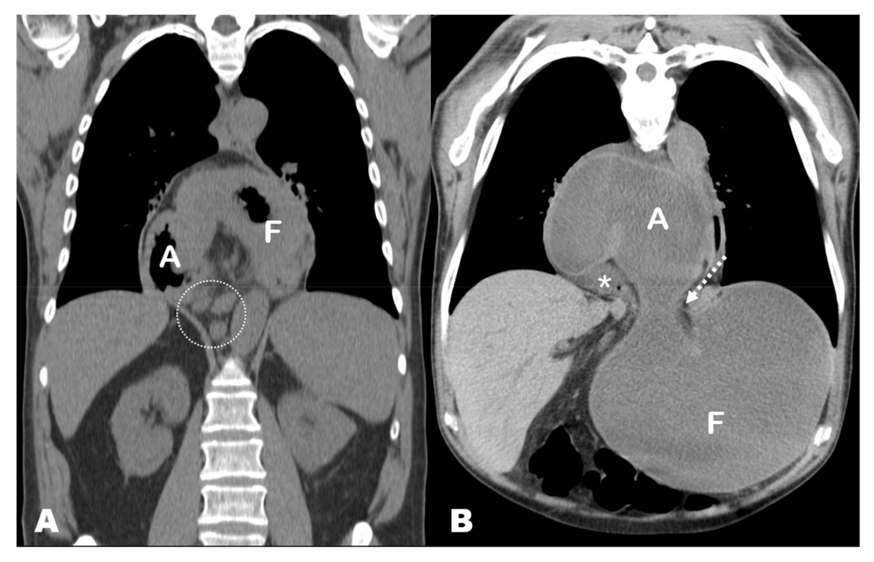 Tomography 08 00019 g004 550