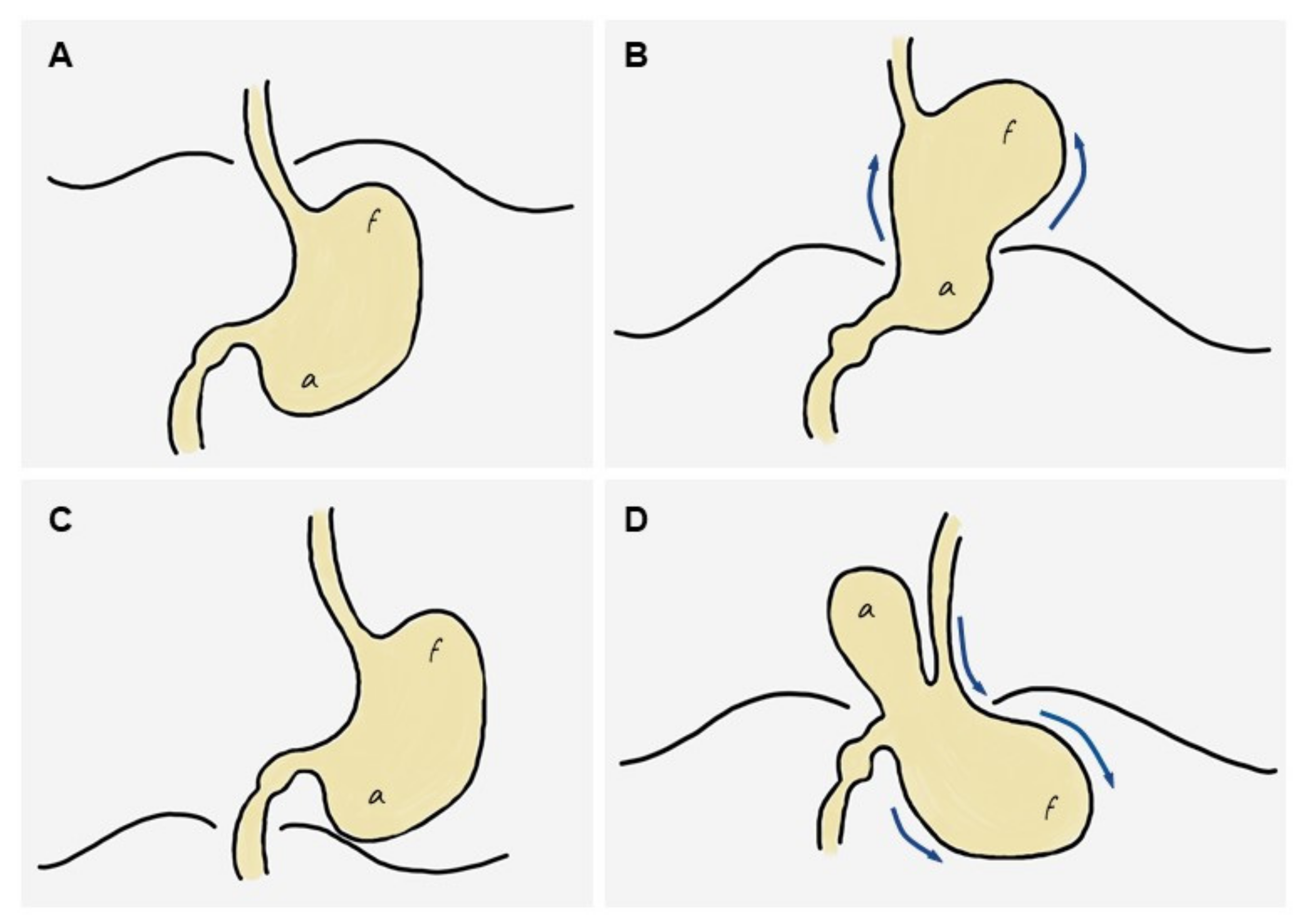 Tomography 08 00019 g005 550
