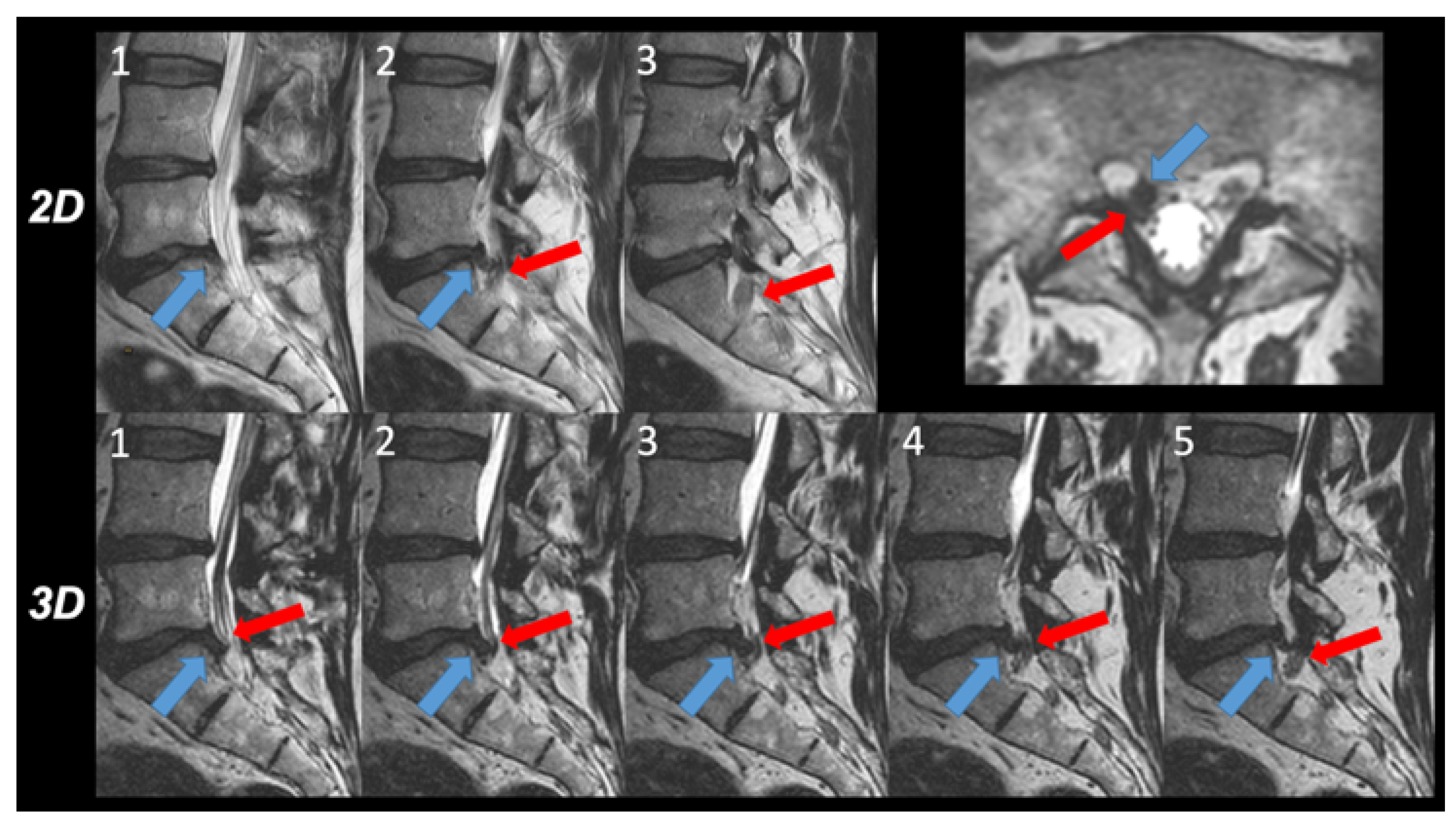 Tomography 08 00020 g002