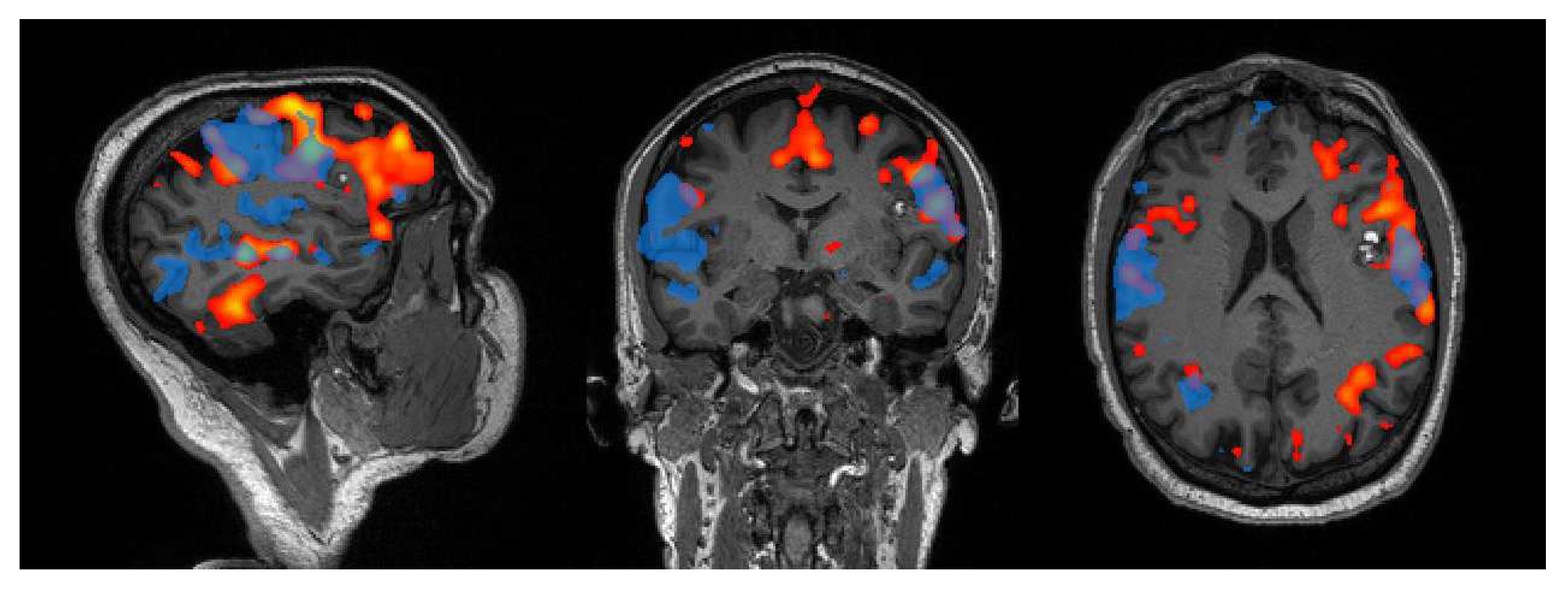 Tomography 08 00021 g002 Tomography 08 00021 g002