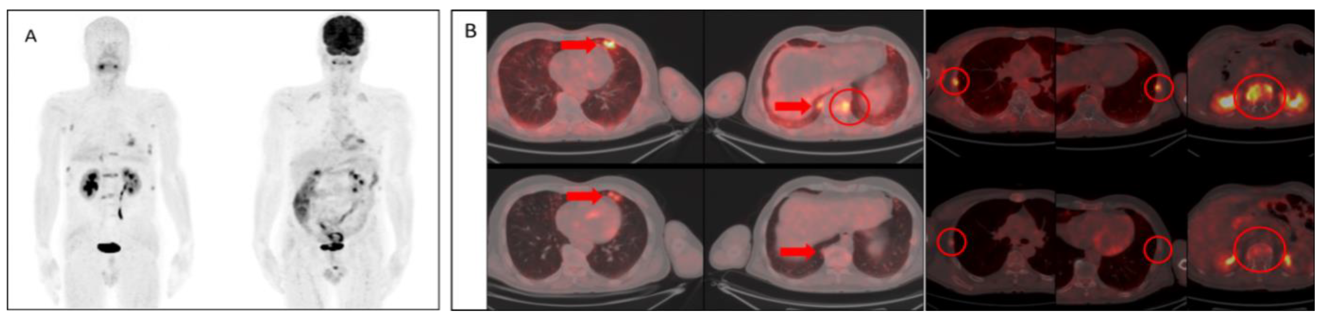 Tomography 08 00024 g001
