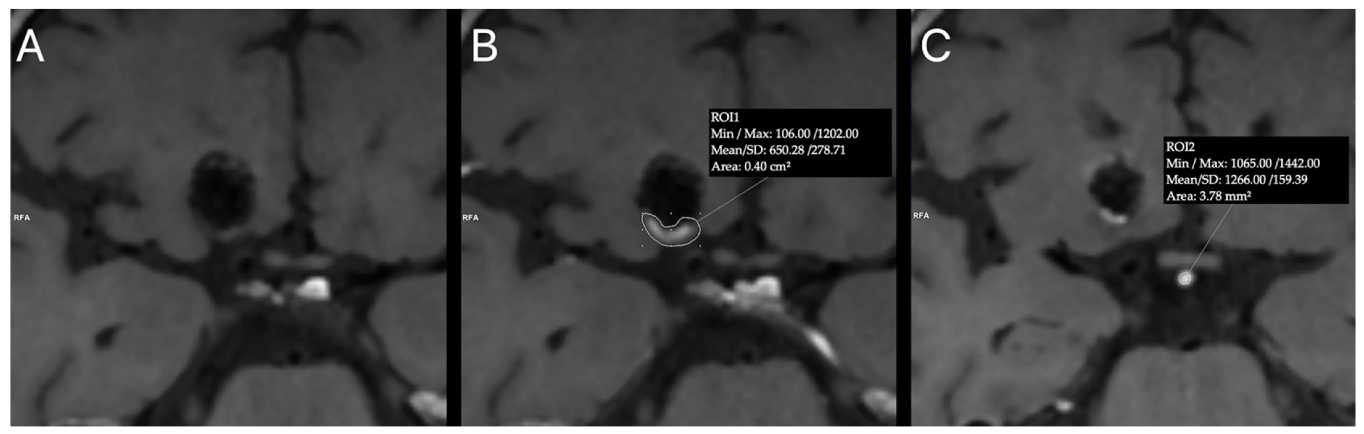 Tomography 08 00025 g001