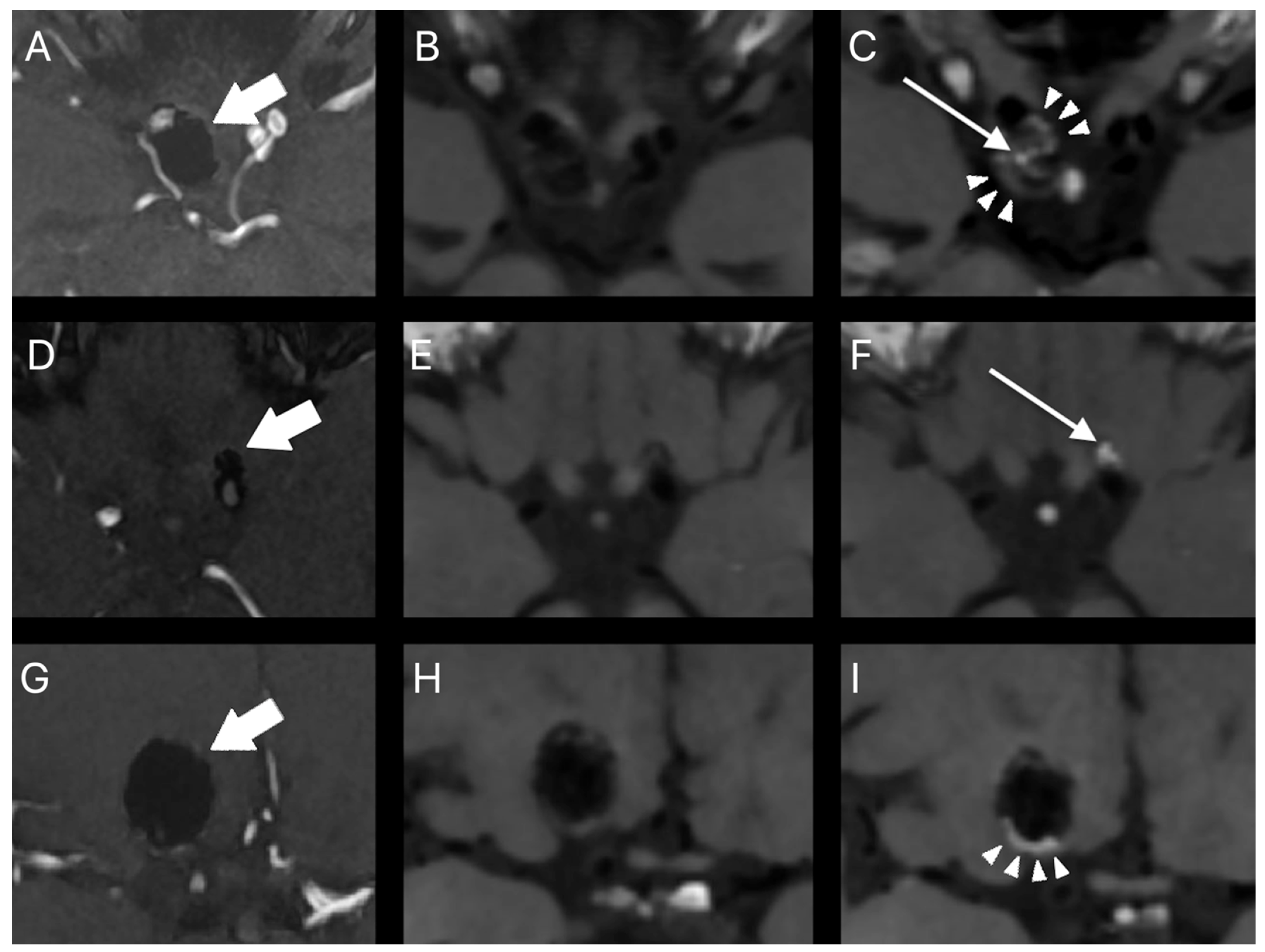 Tomography 08 00025 g002