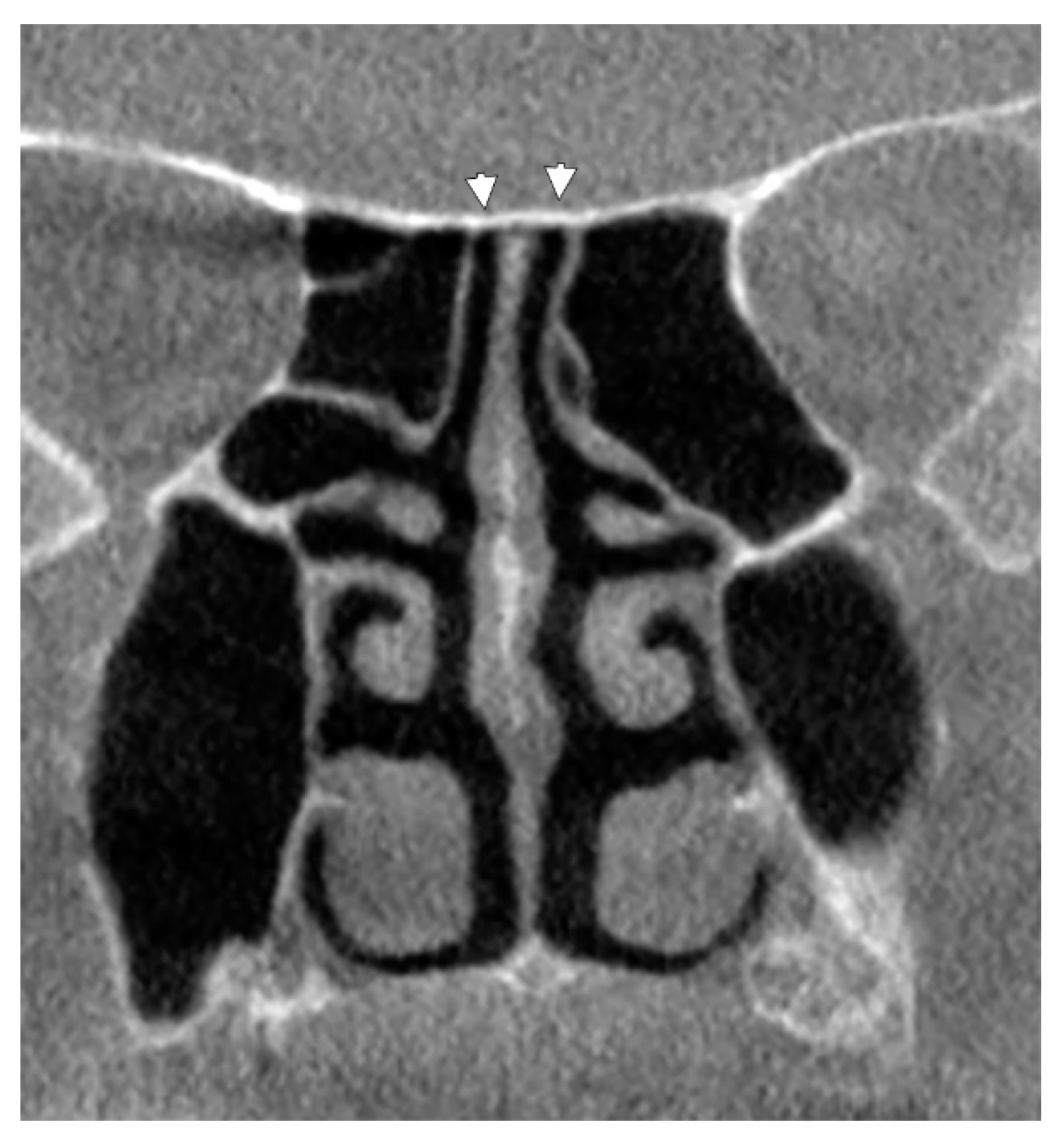 Tomography 08 00026 g002