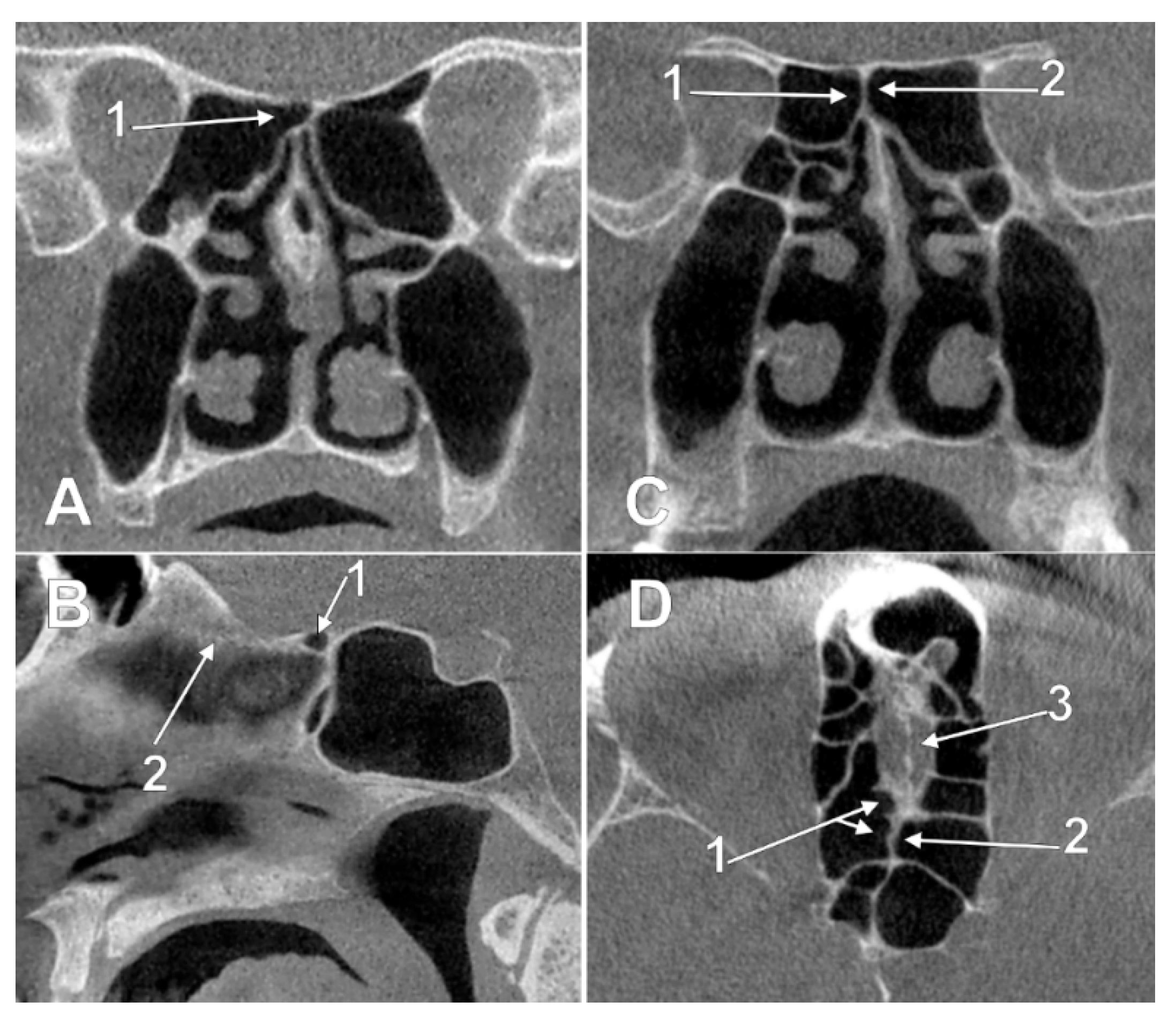 Tomography 08 00026 g003