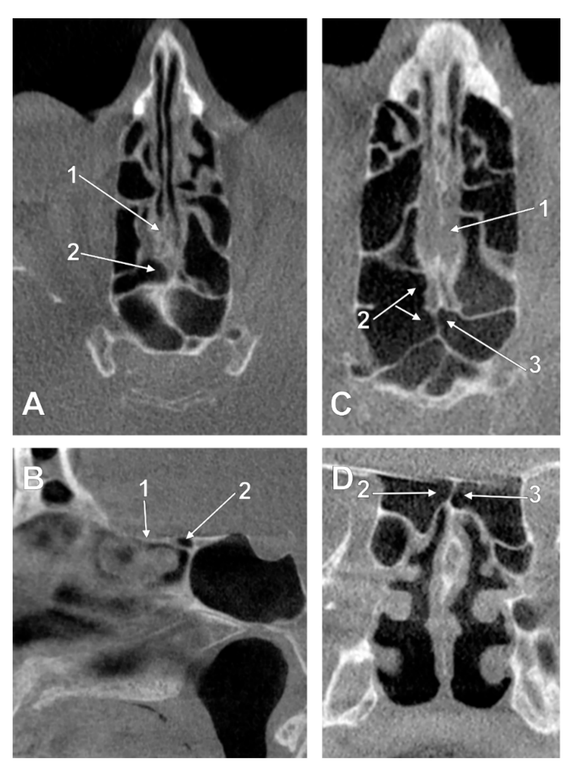 Tomography 08 00026 g004