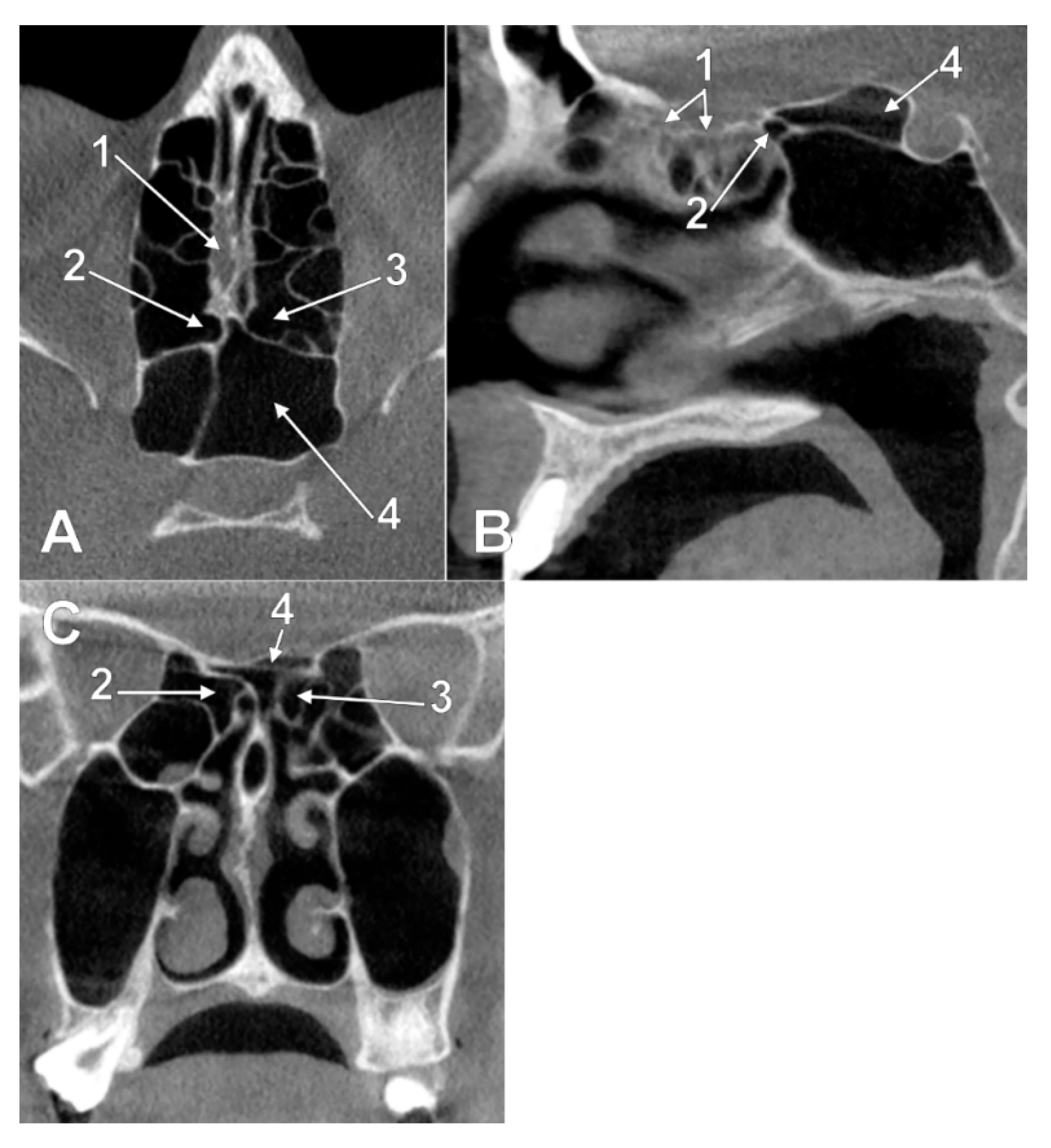 Tomography 08 00026 g006