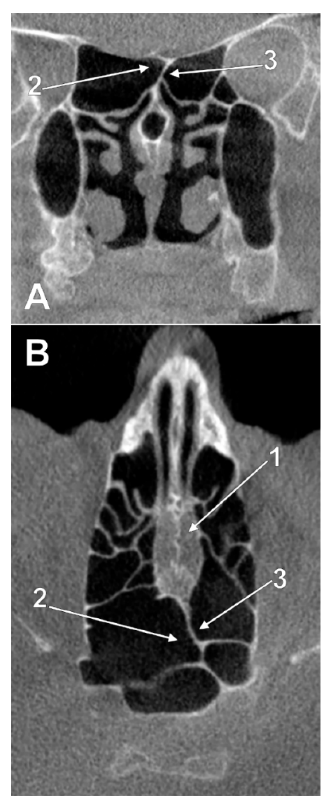 Tomography 08 00026 g009