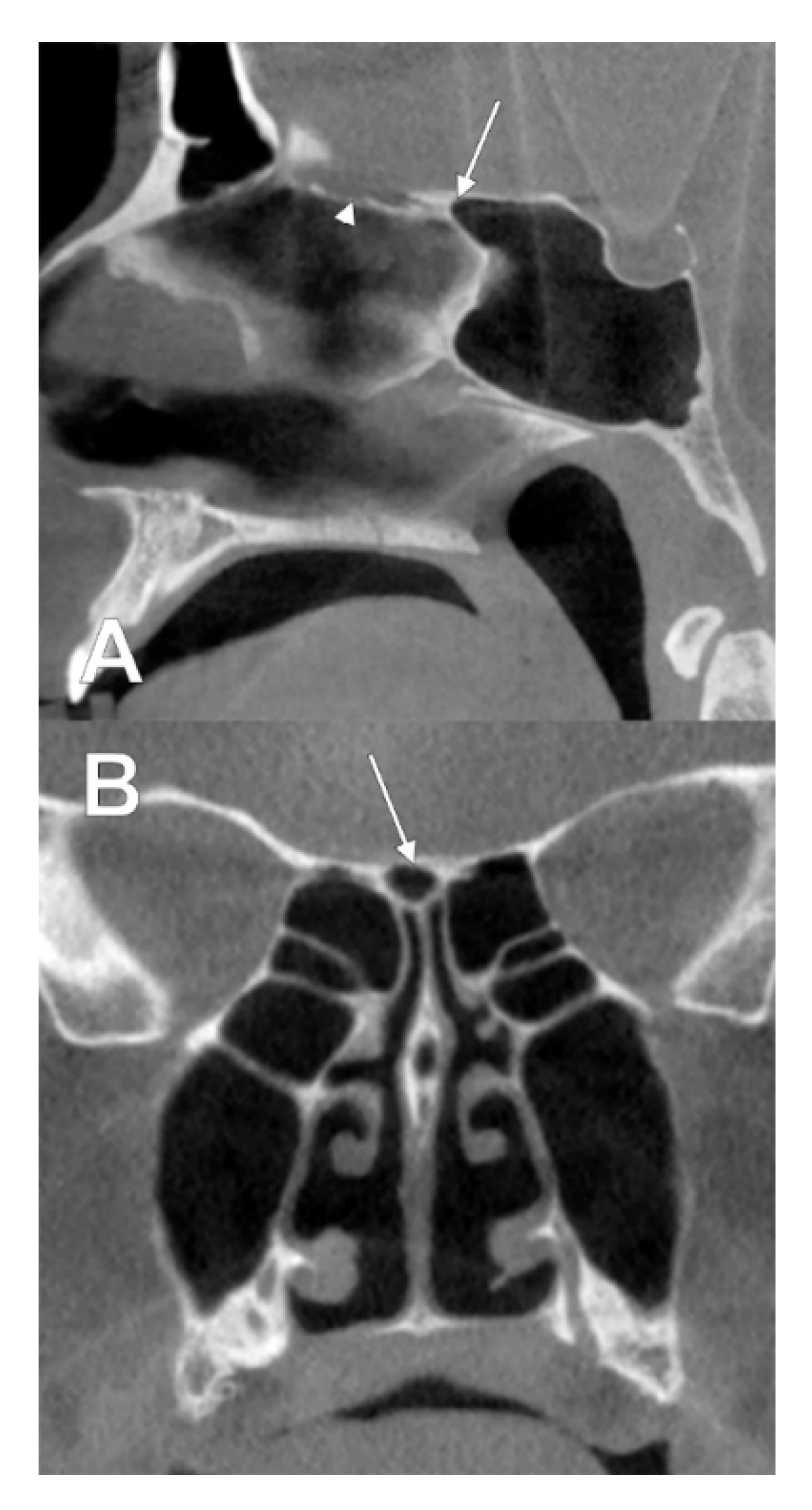 Tomography 08 00026 g010
