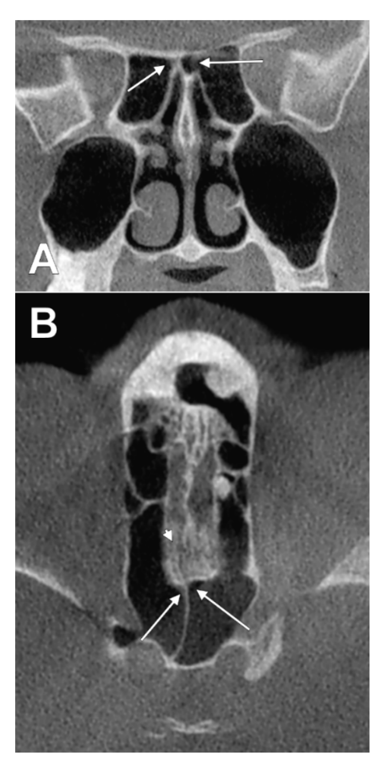 Tomography 08 00026 g011