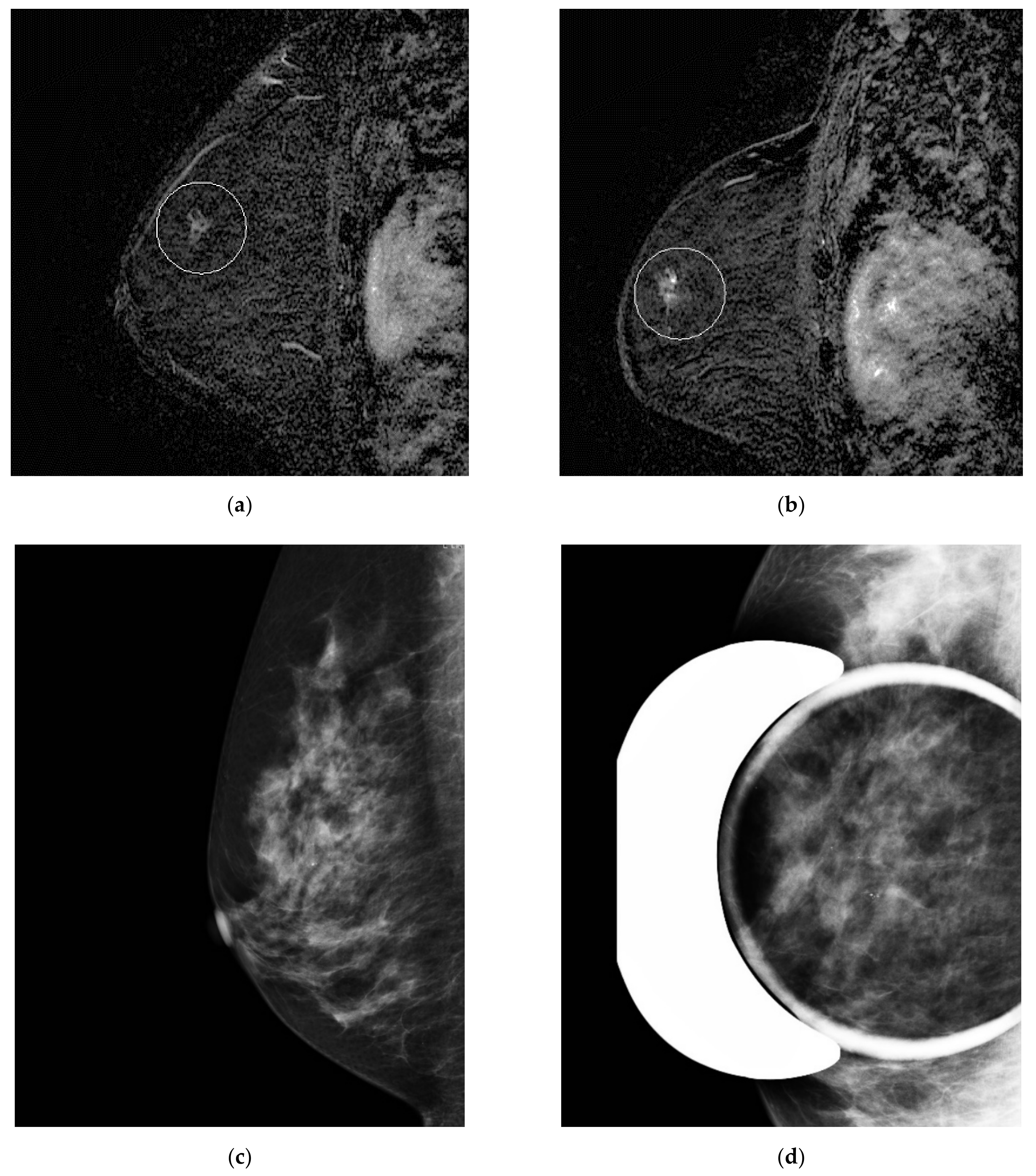 Tomography 08 00027 g003 550