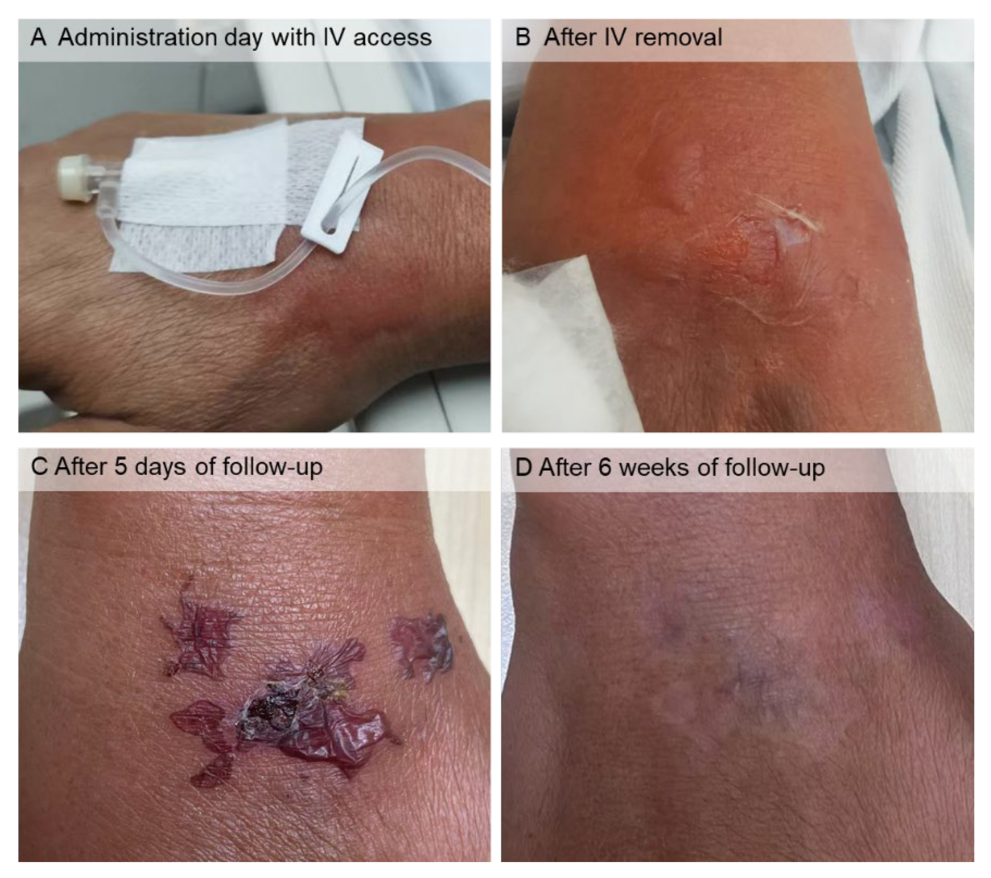 Tomography 08 00029 g002 550