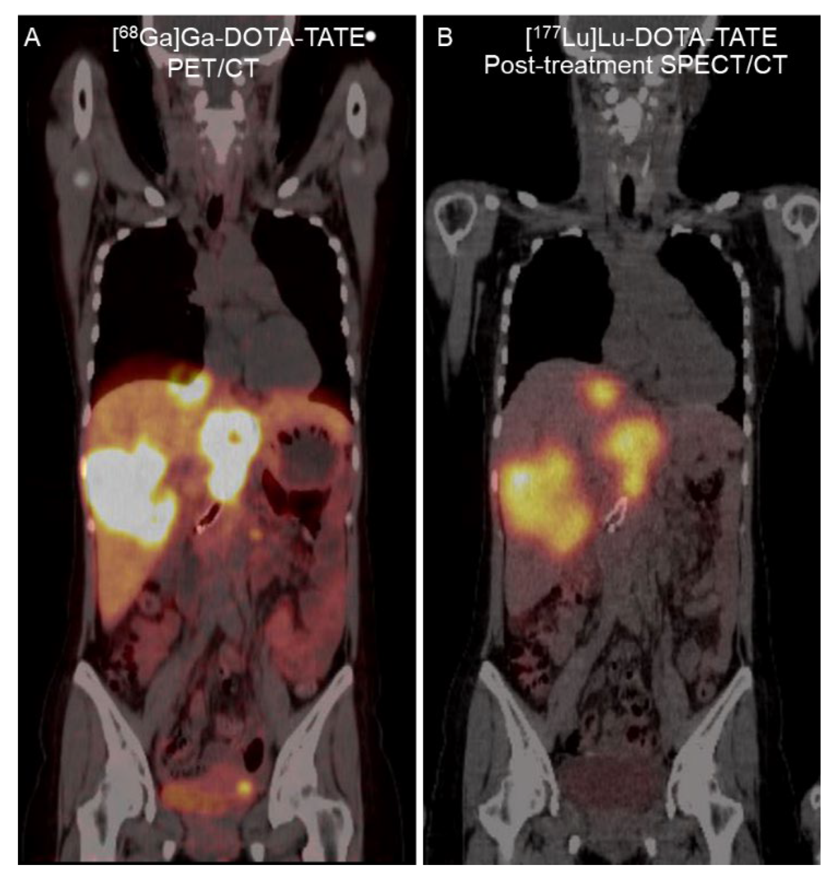 Tomography 08 00029 g003 550