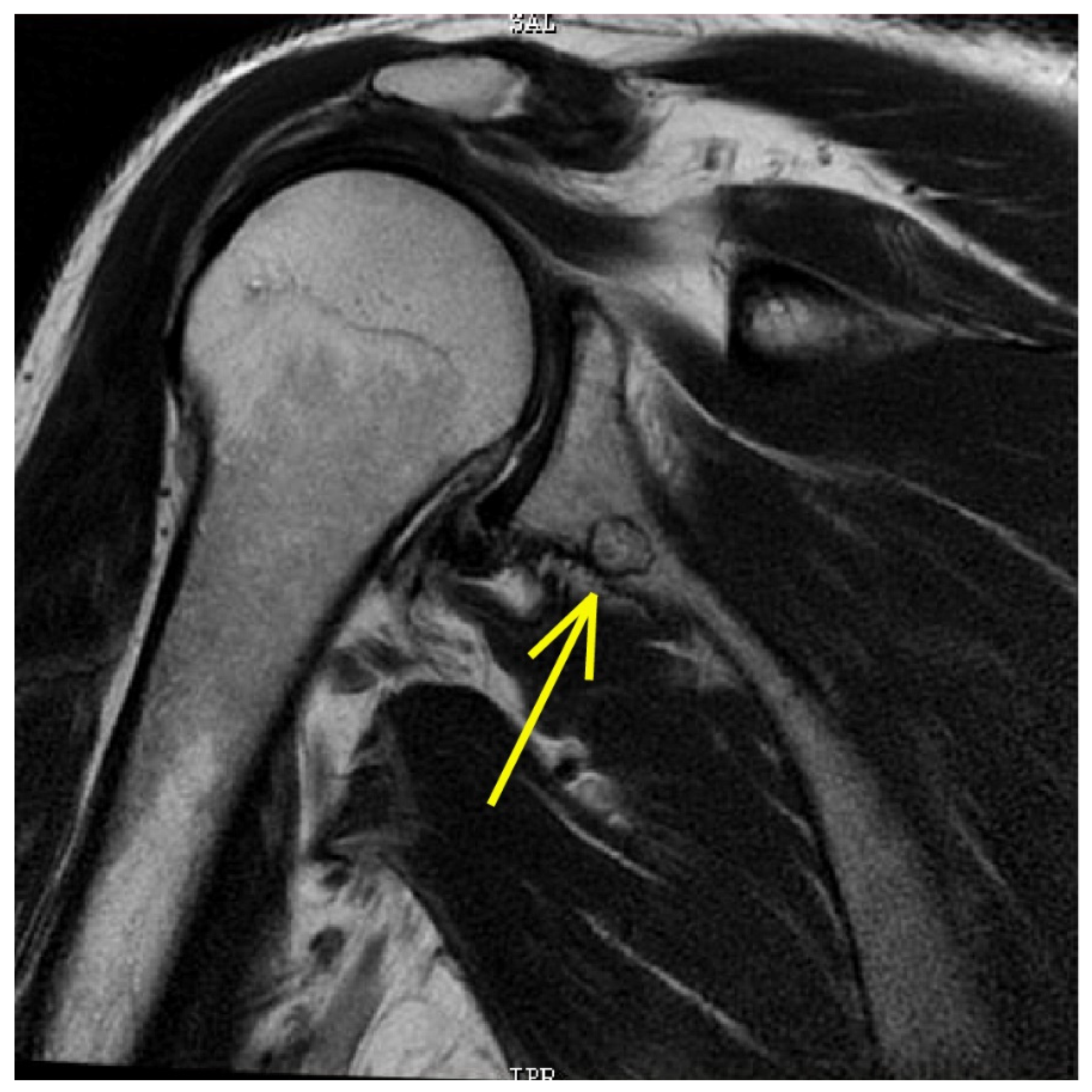Tomography 08 00032 g004 Tomography 08 00032 g004