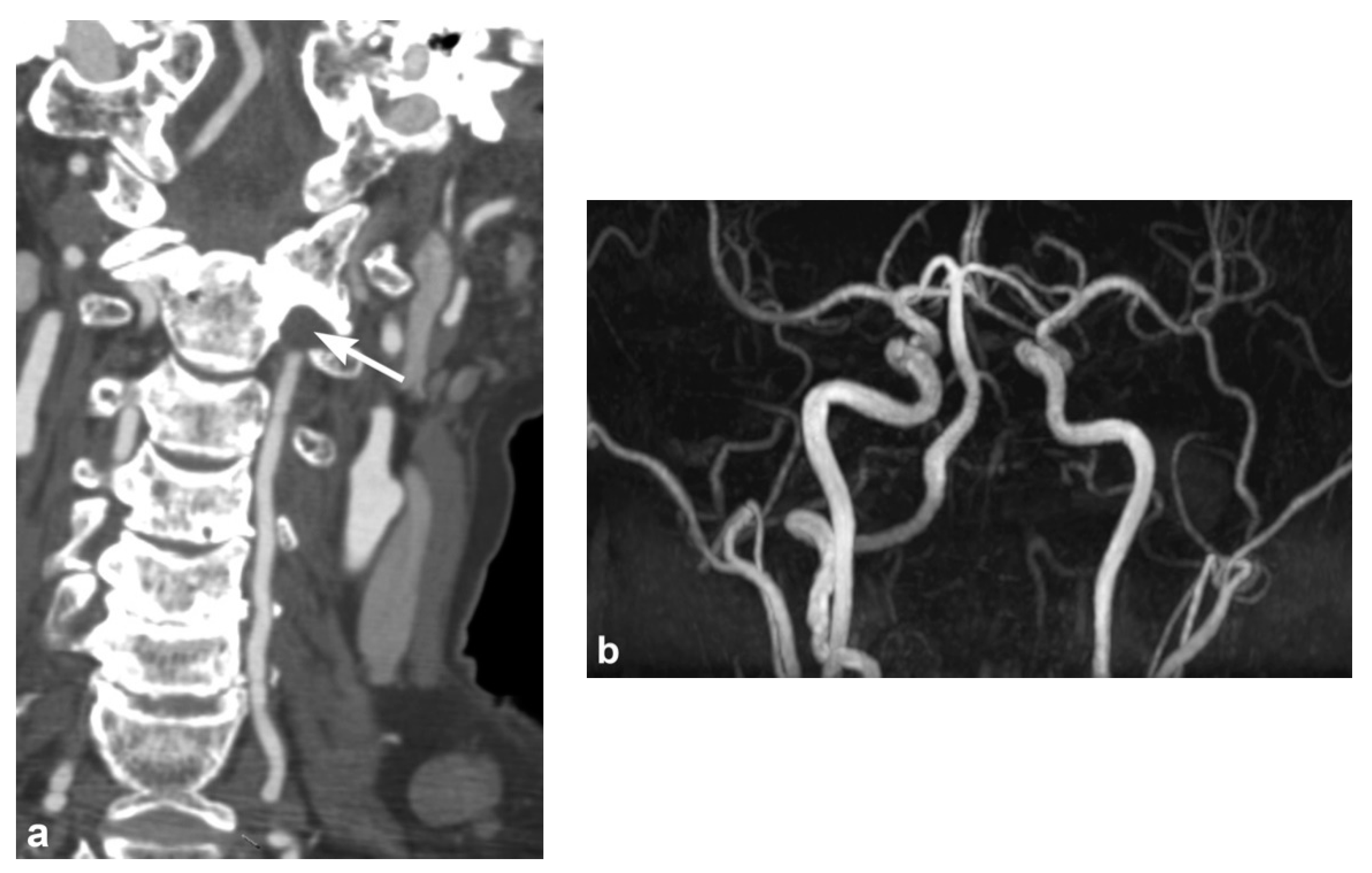 Tomography 08 00033 g012 Tomography 08 00033 g012