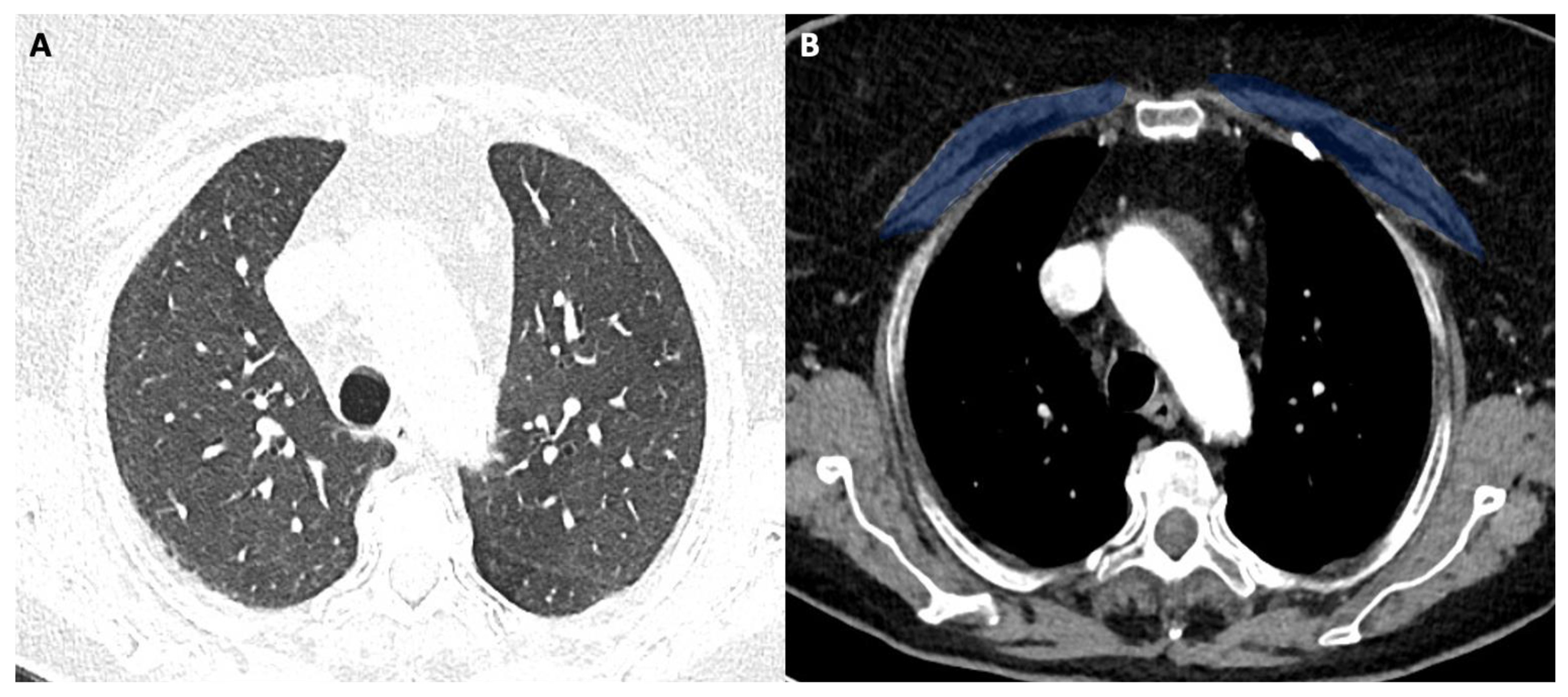 Tomography 08 00034 g002 550