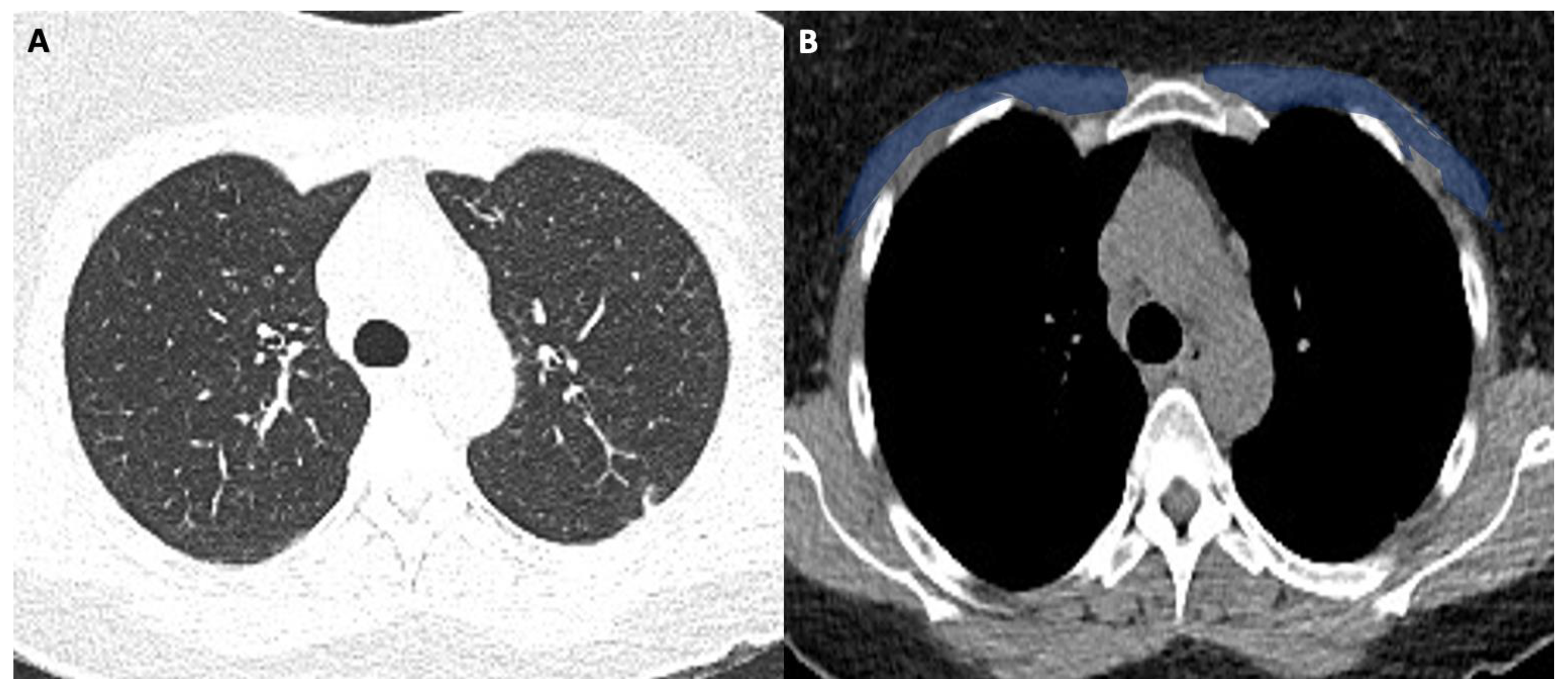 Tomography 08 00034 g003 550