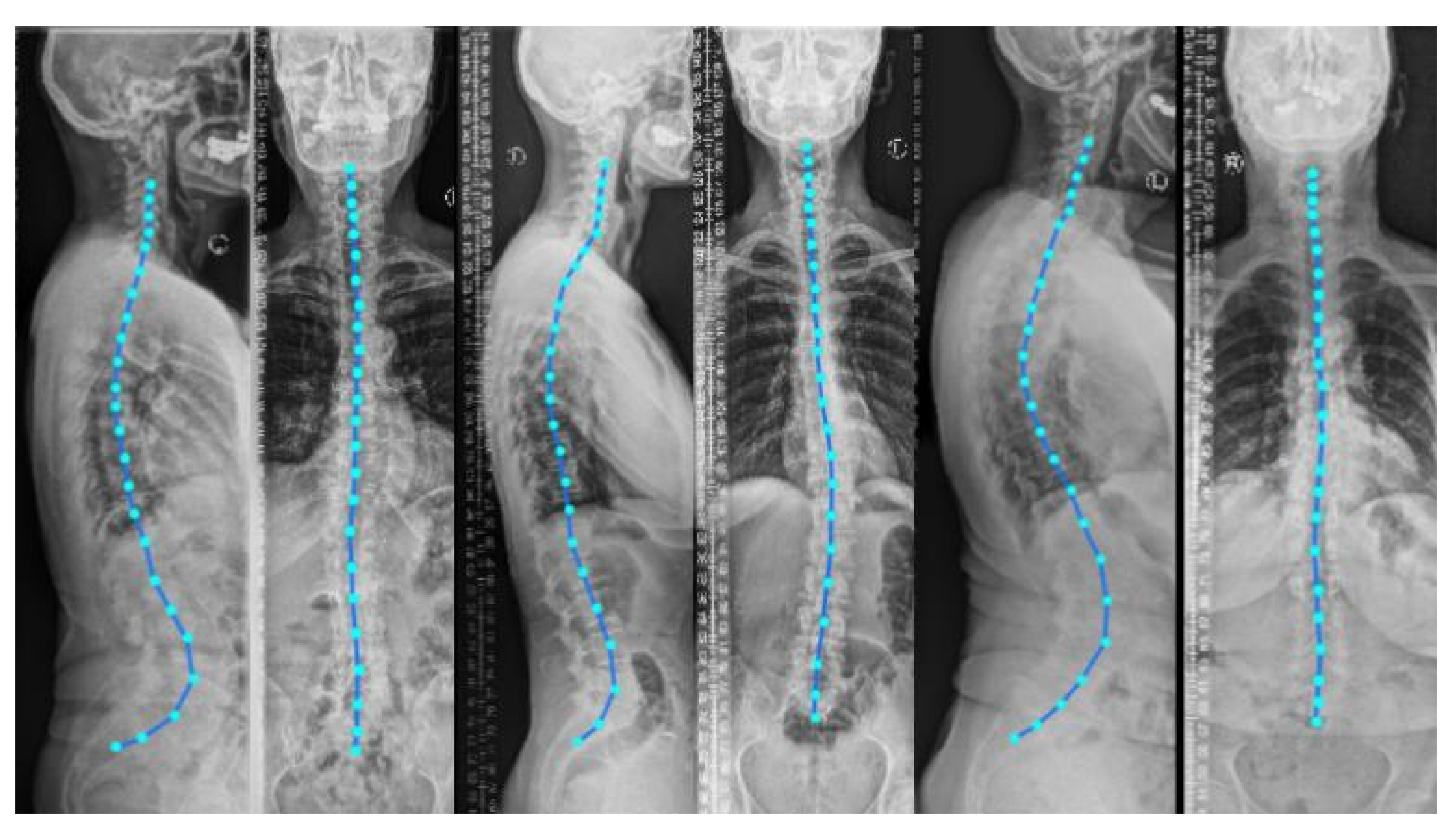 Tomography 08 00039 g001