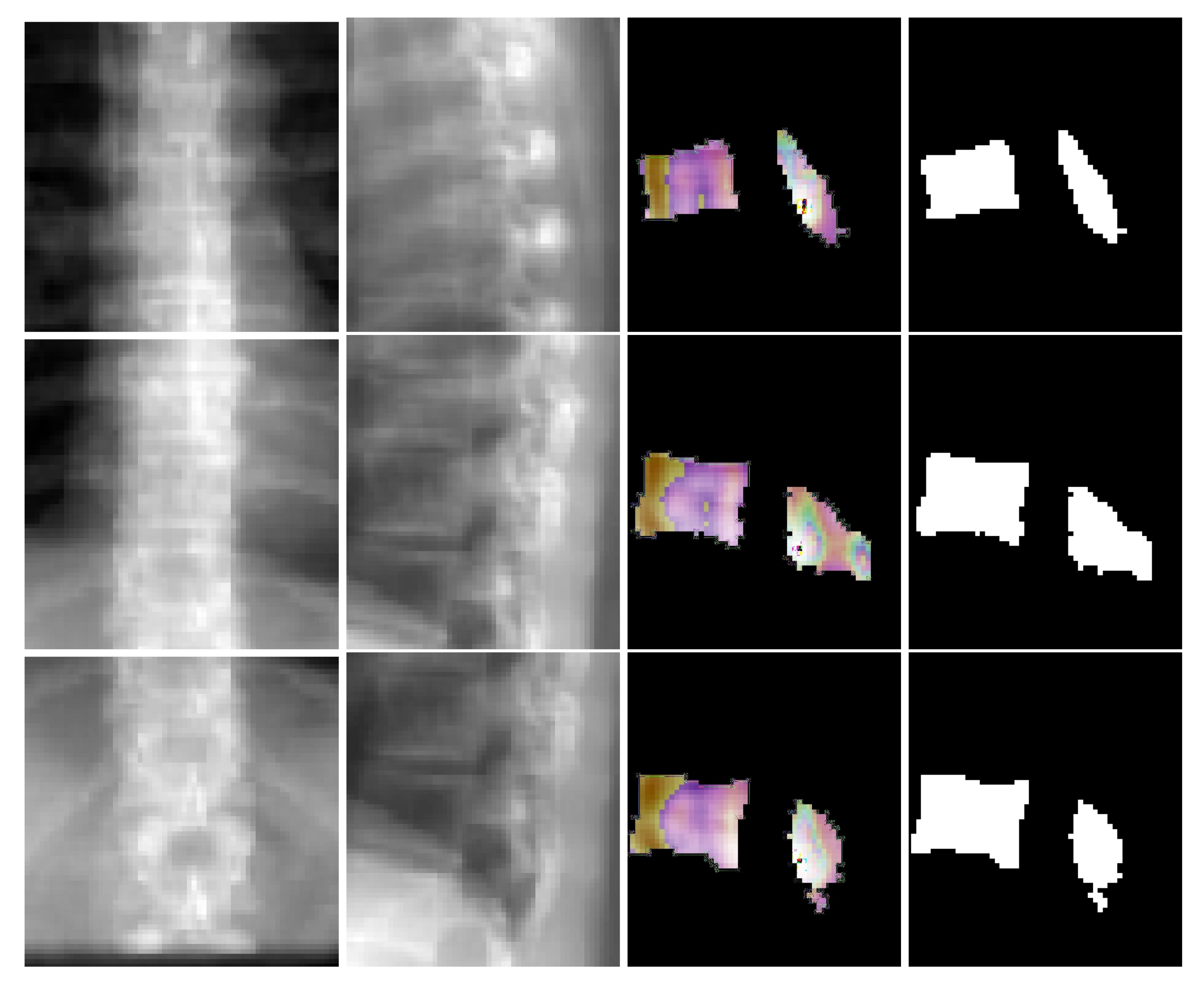 Tomography 08 00039 g006