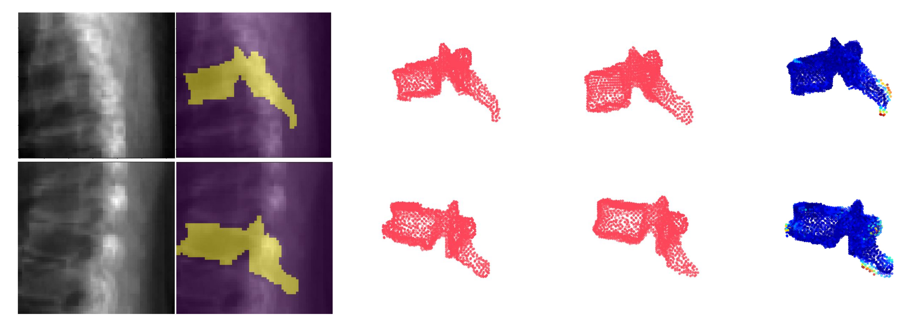 Tomography 08 00039 g007